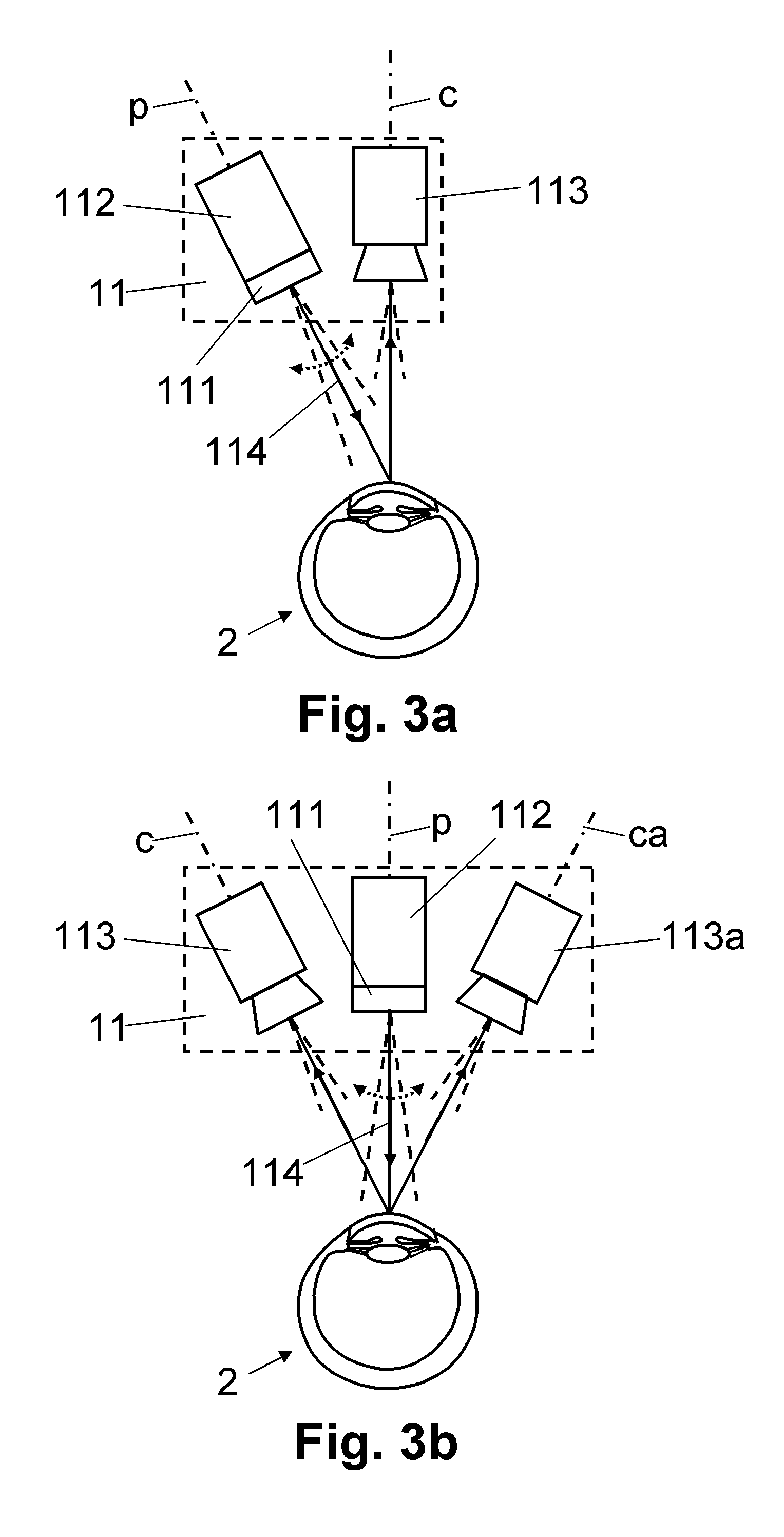 Ophthalmological measuring device and measurement method