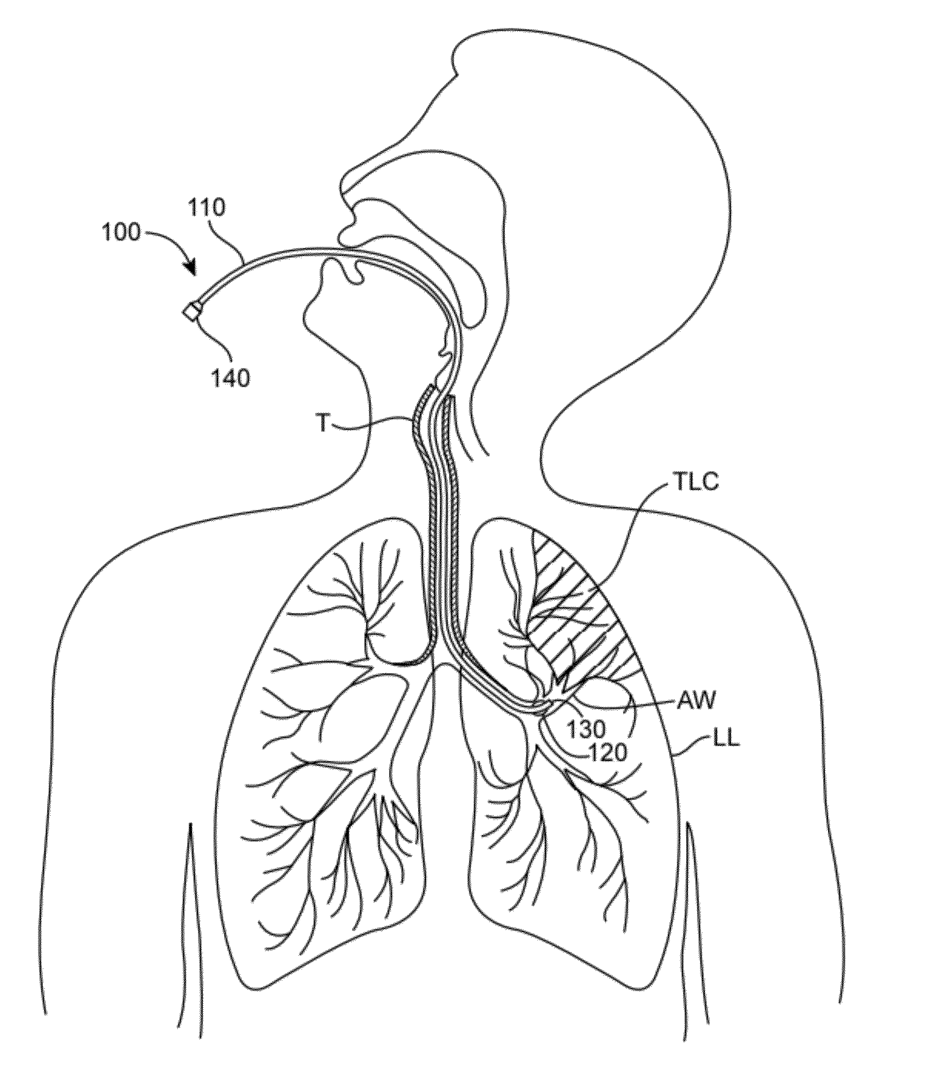 Methods and systems for endobronchial diagnosis