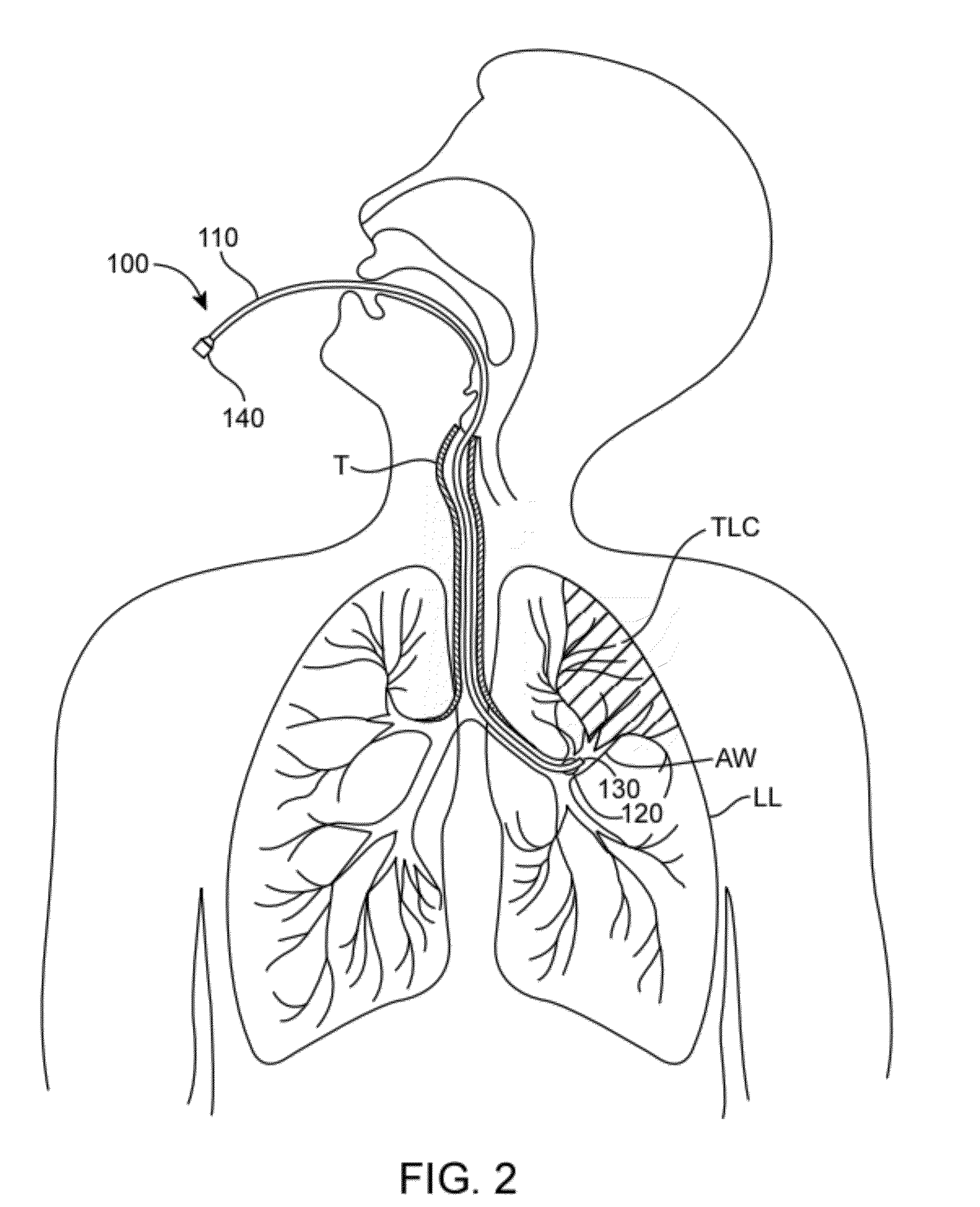Methods and systems for endobronchial diagnosis