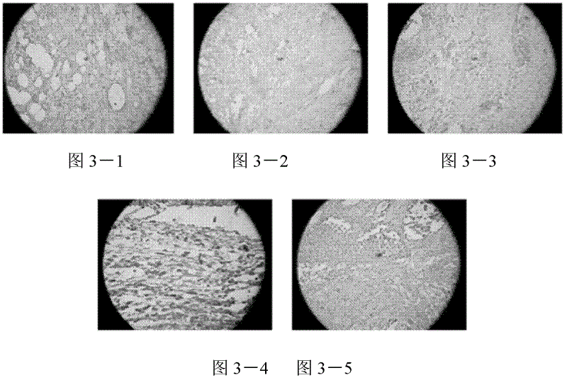 Application of carbon monoxide molecules in inhibition on acute rejection after skin grafting