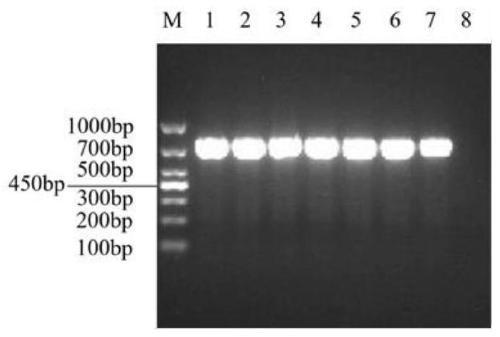 Multi-RT-PCR detection primer set for TGEV, PEDV, SADS-CoV and PDCoV