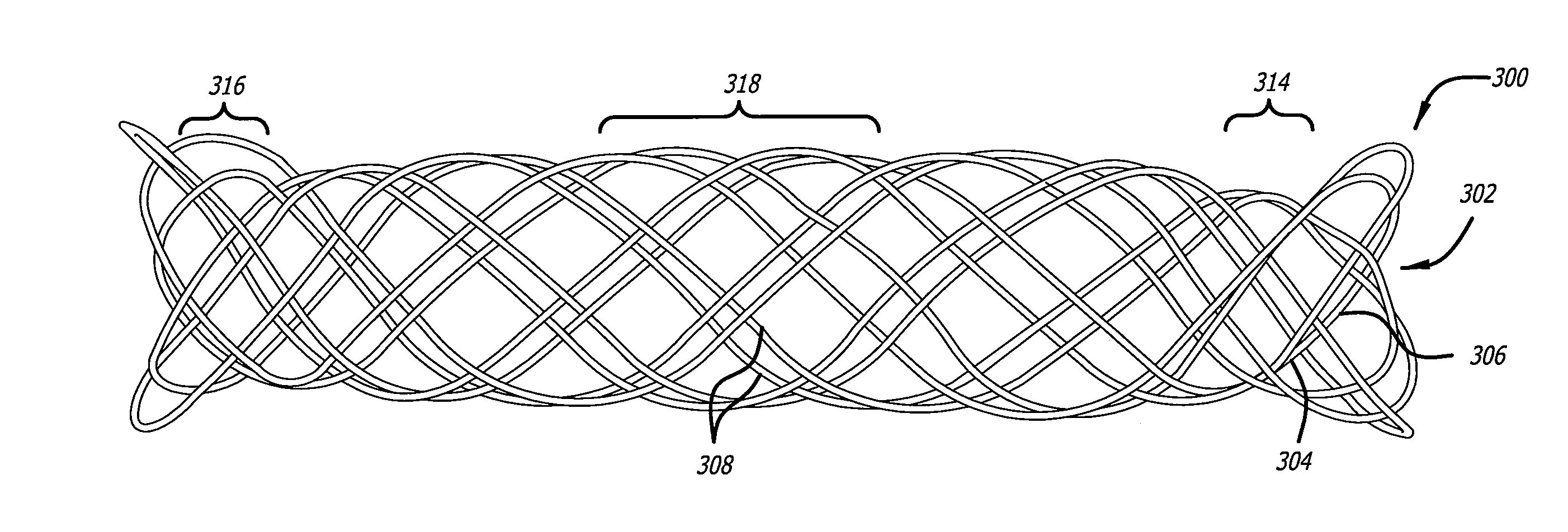 Tracheobronchial implantable medical device and methods of use