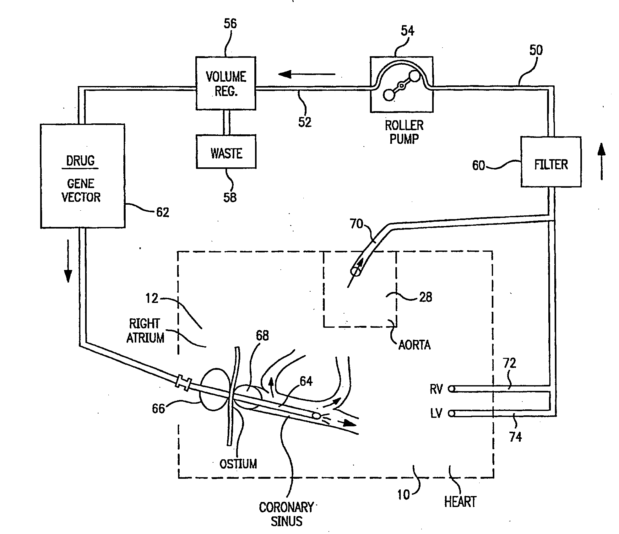 Perfusion circuit and use therein in targeted delivery of macromolecules