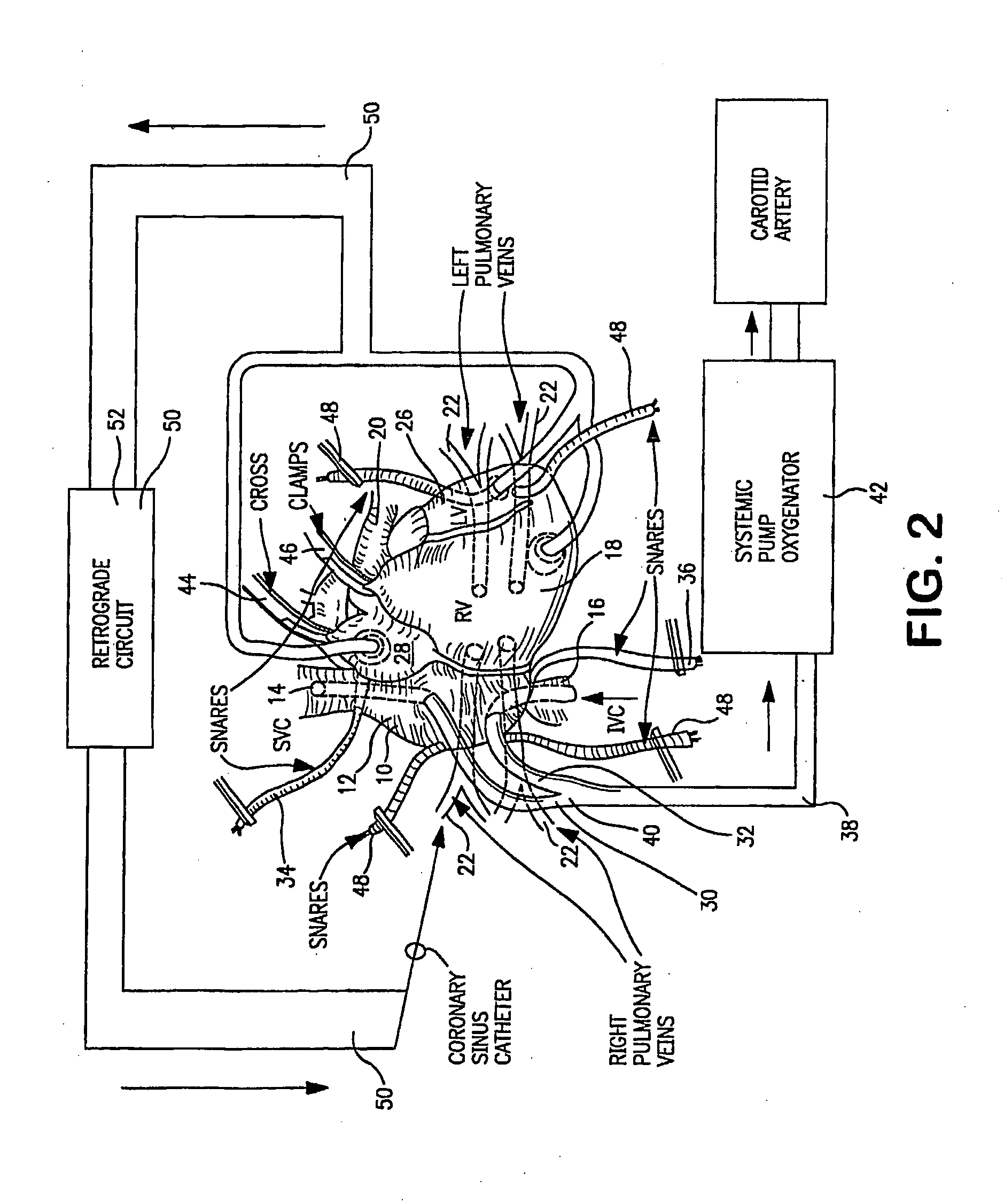 Perfusion circuit and use therein in targeted delivery of macromolecules