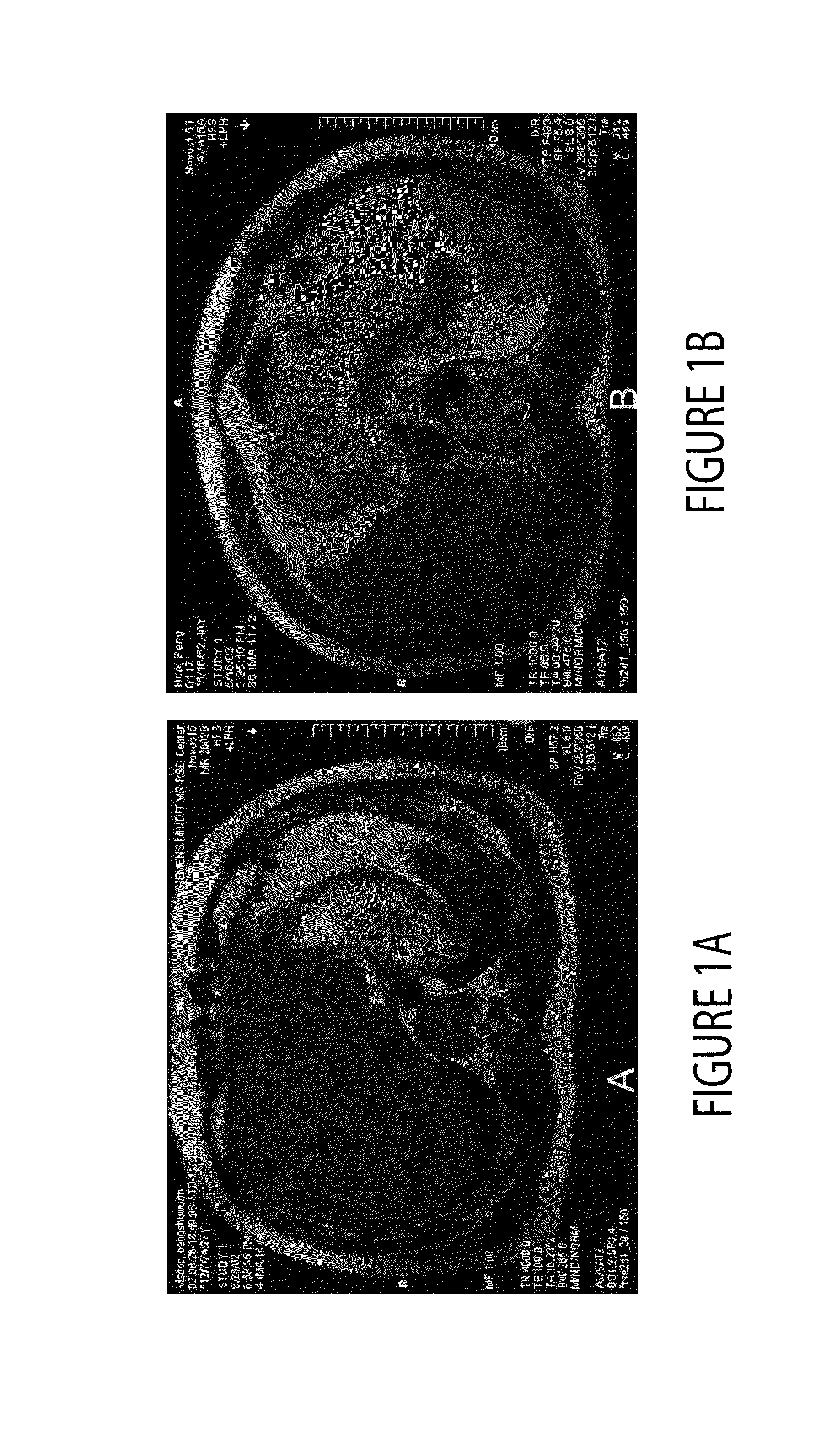 Motion compensated MR imaging system