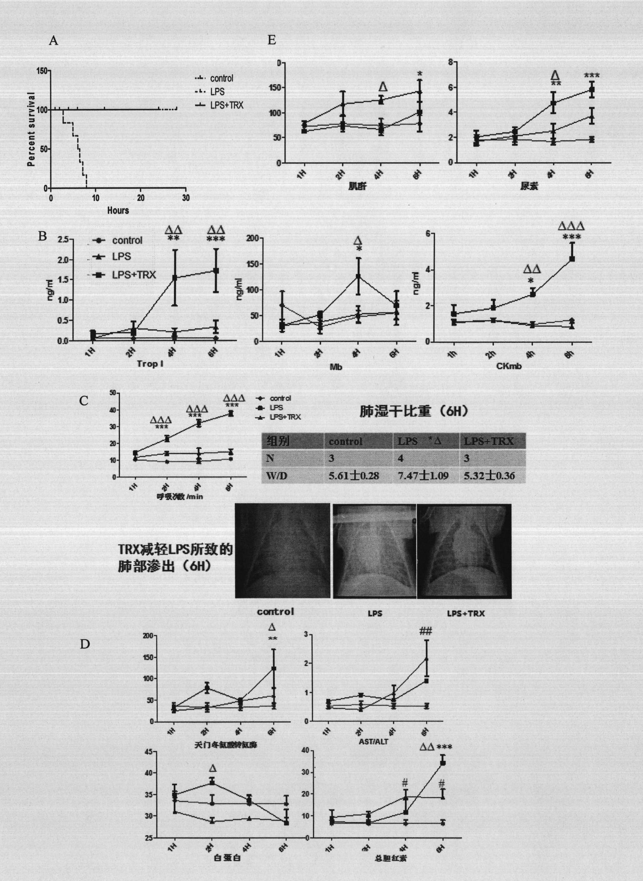 Application of thioredoxin to preparing medicament for curing pyemia and preventing multiple-organ dysfunction syndrome (MODS) caused by pyemia