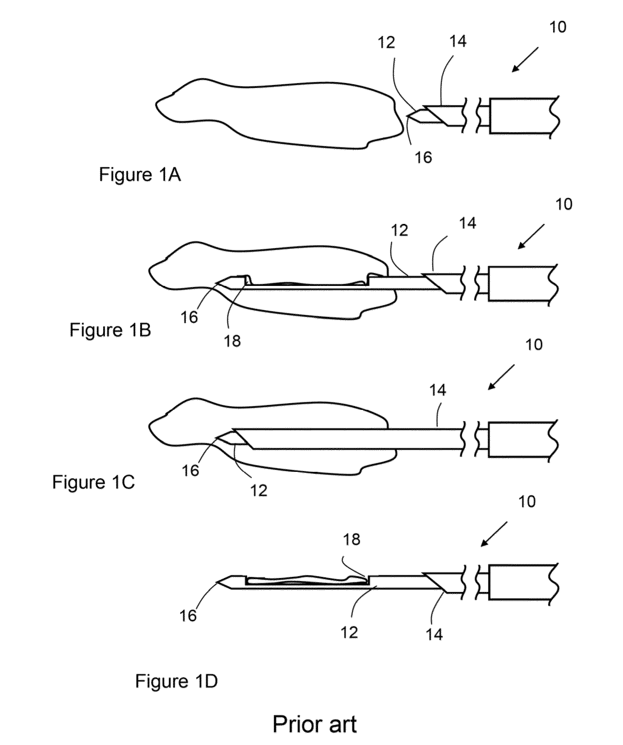 Device and method for handling biological tissues