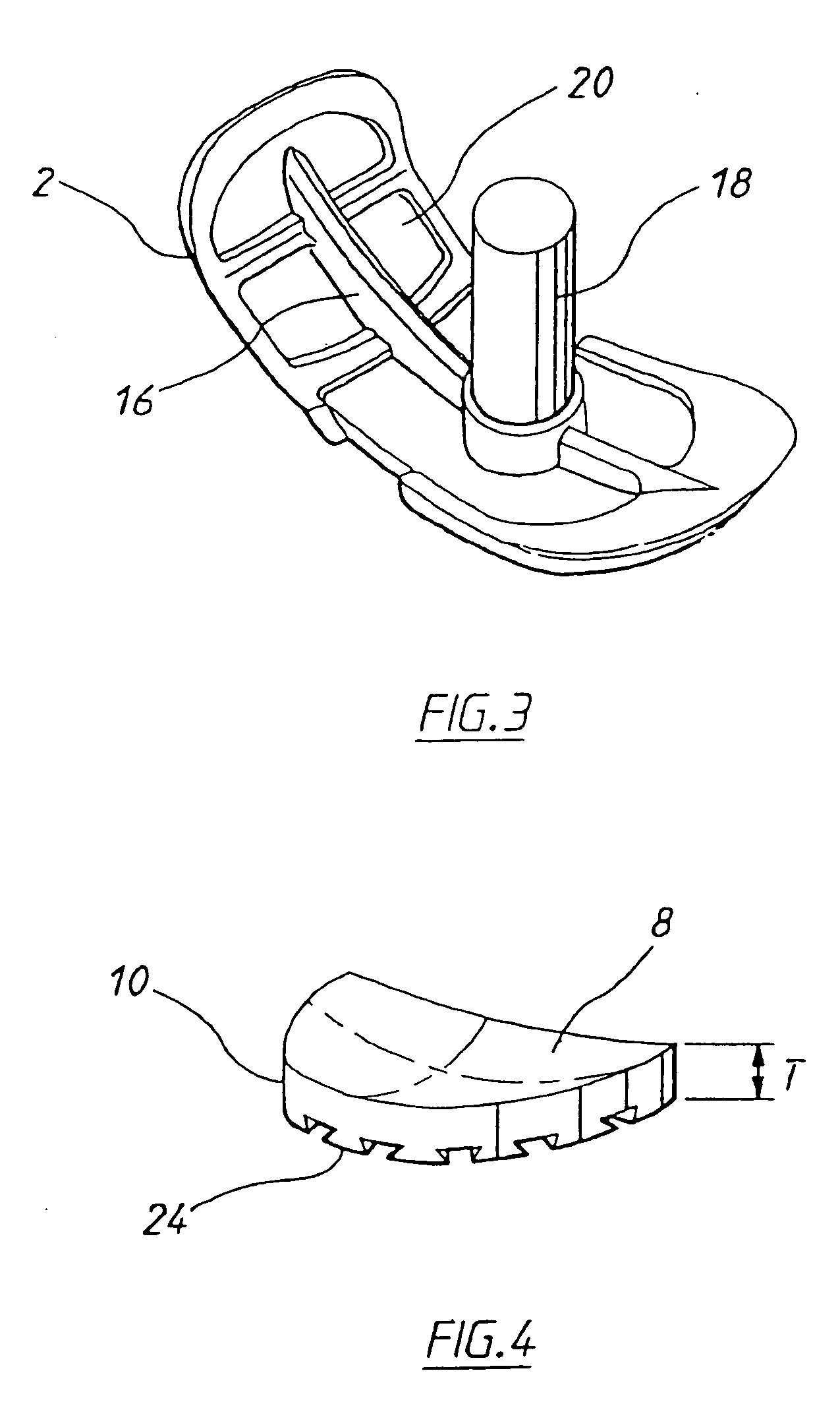Method of arthroplastly on a knee joint and apparatus for use in same