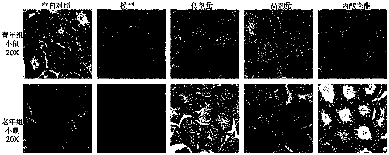 Application of compound preparation containing angelica keiskei to a medicine for preventing or treating sexual dysfunction