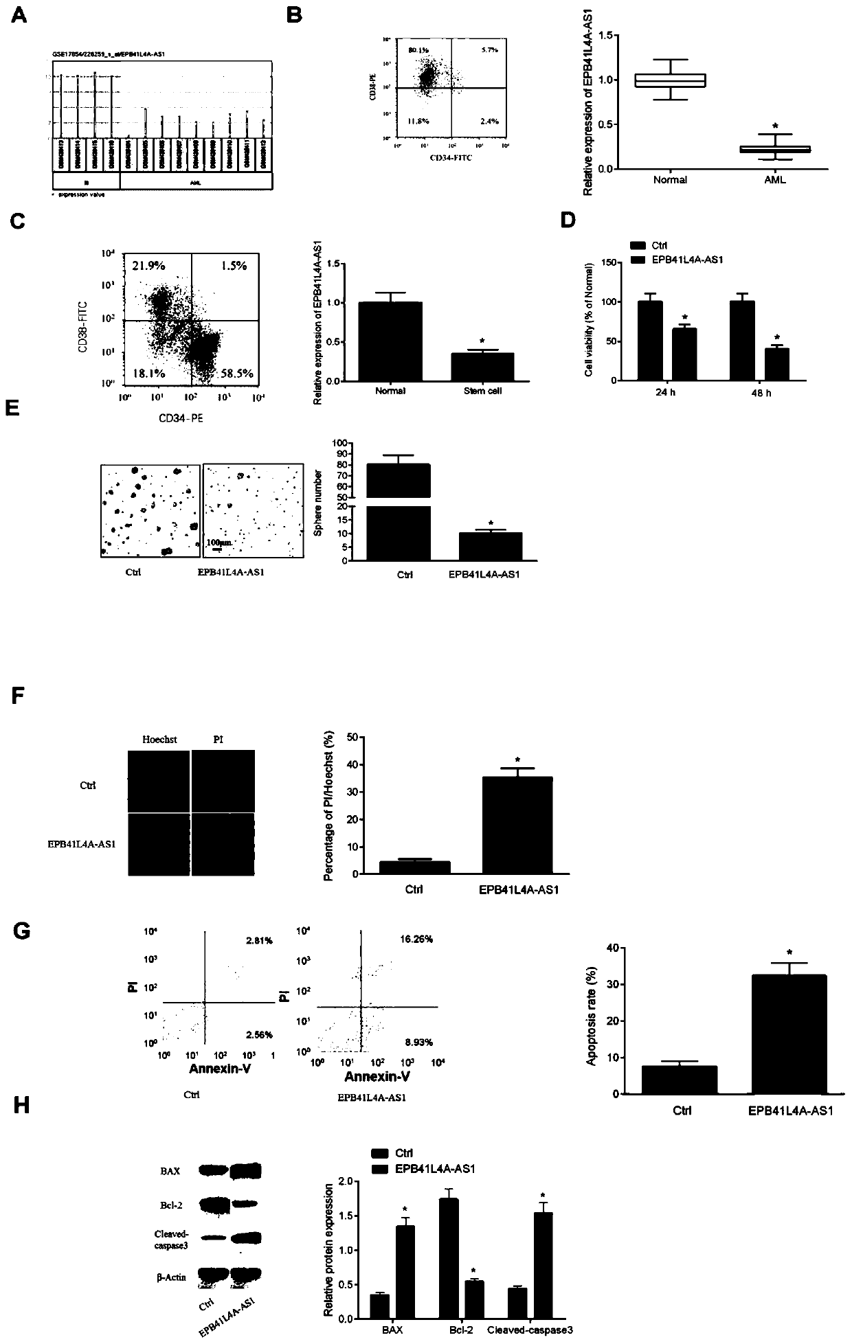 Application of LncRNA EPB41L4A-AS1 as marker for diagnosing and treating acute myelogenous leukemia