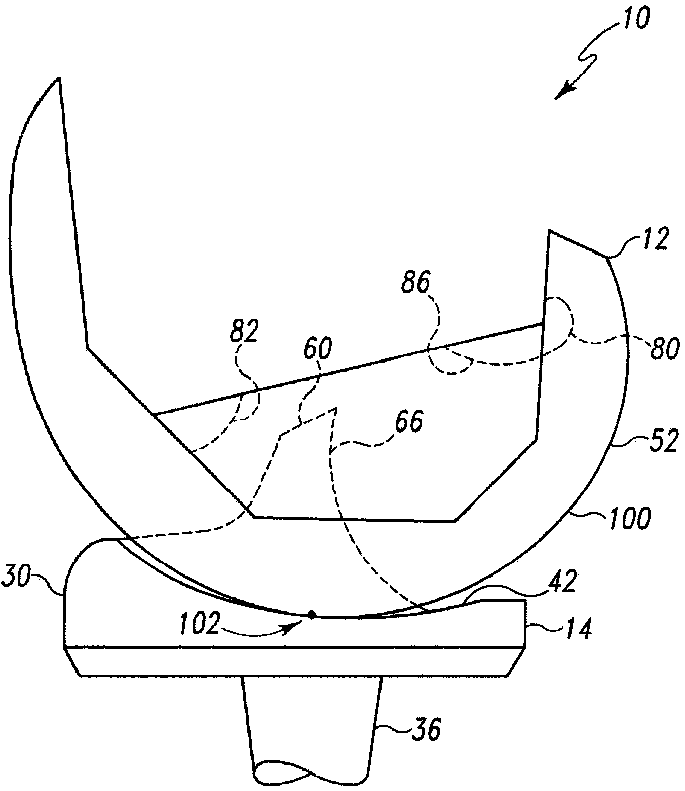 Posterior stabilized orthopaedic knee prosthesis having controlled condylar curvature