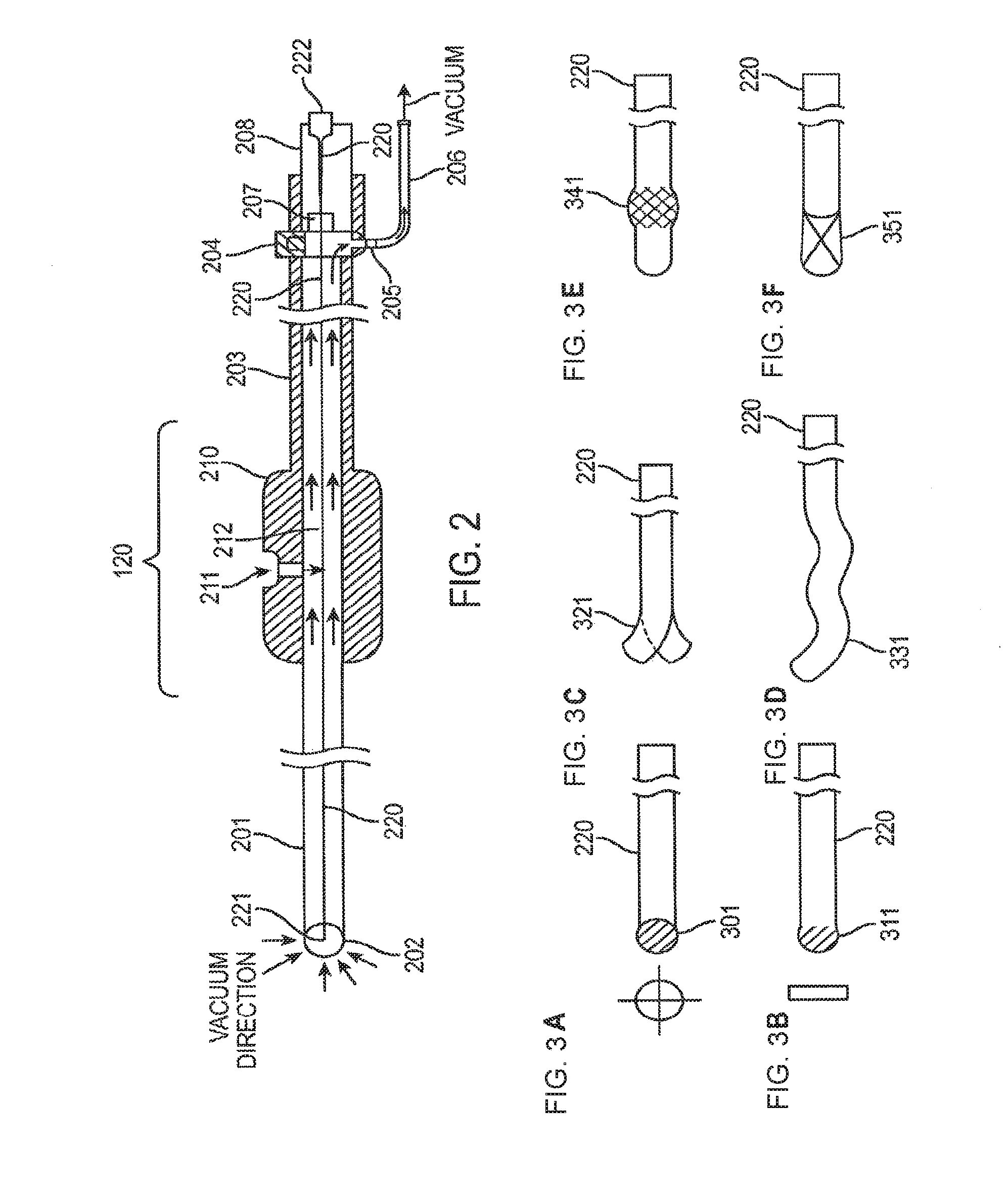 Methods and devices for removing obstructing material from the human body