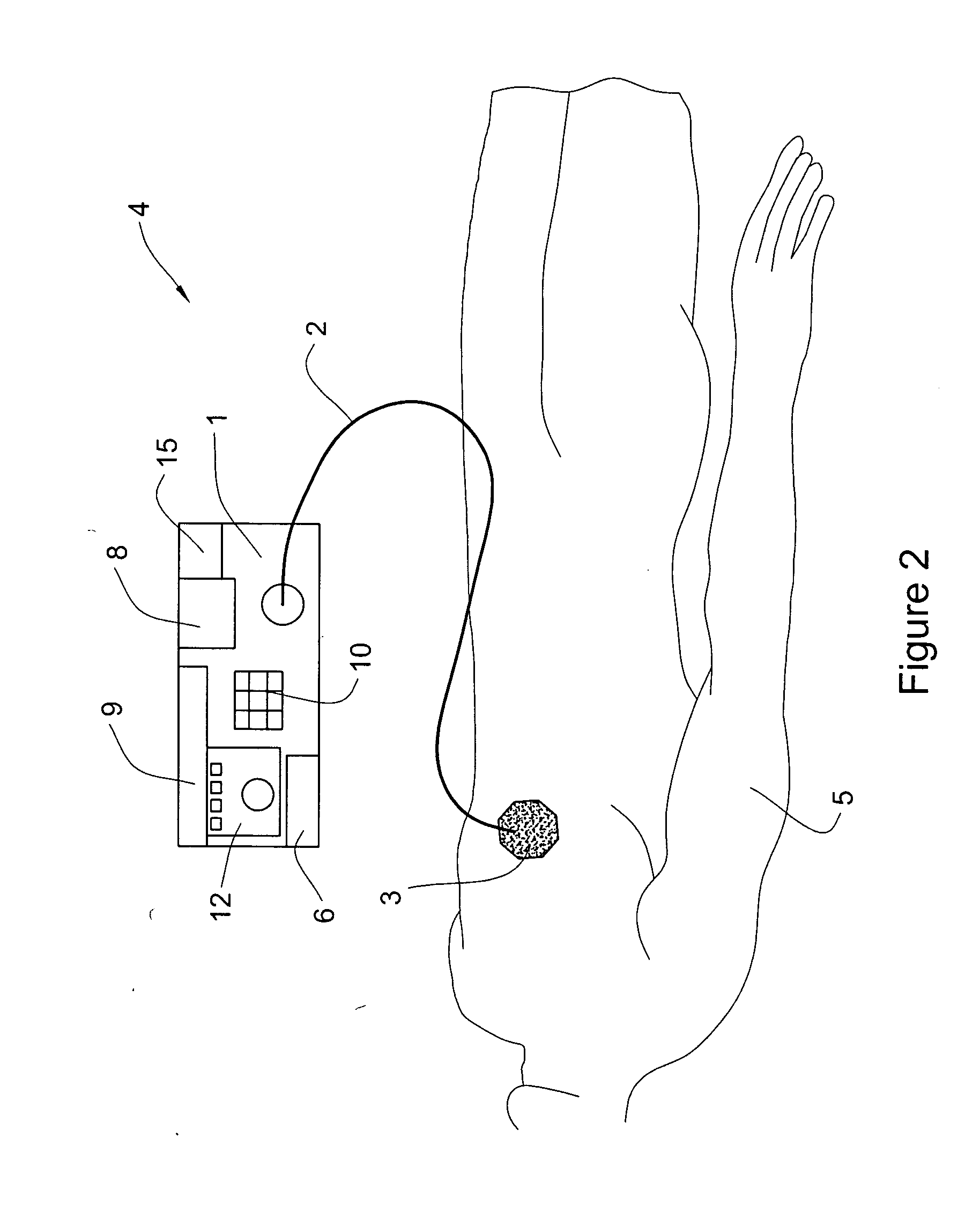 Method and apparatus for treatment of adipose tissue