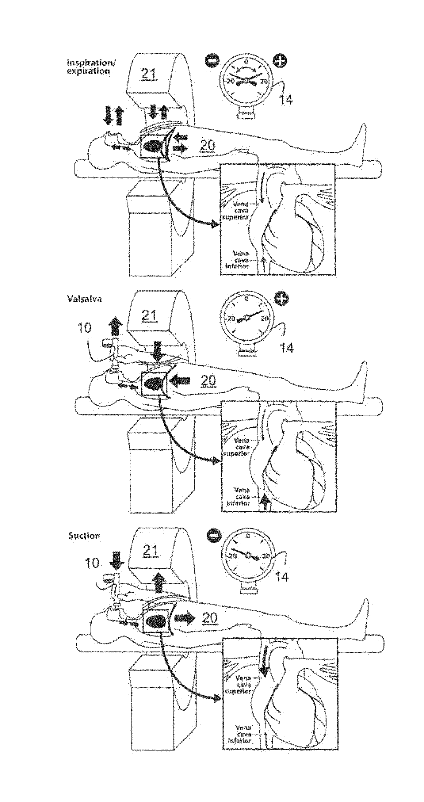 Blood flow control system and methods for in-vivo imaging and other applications
