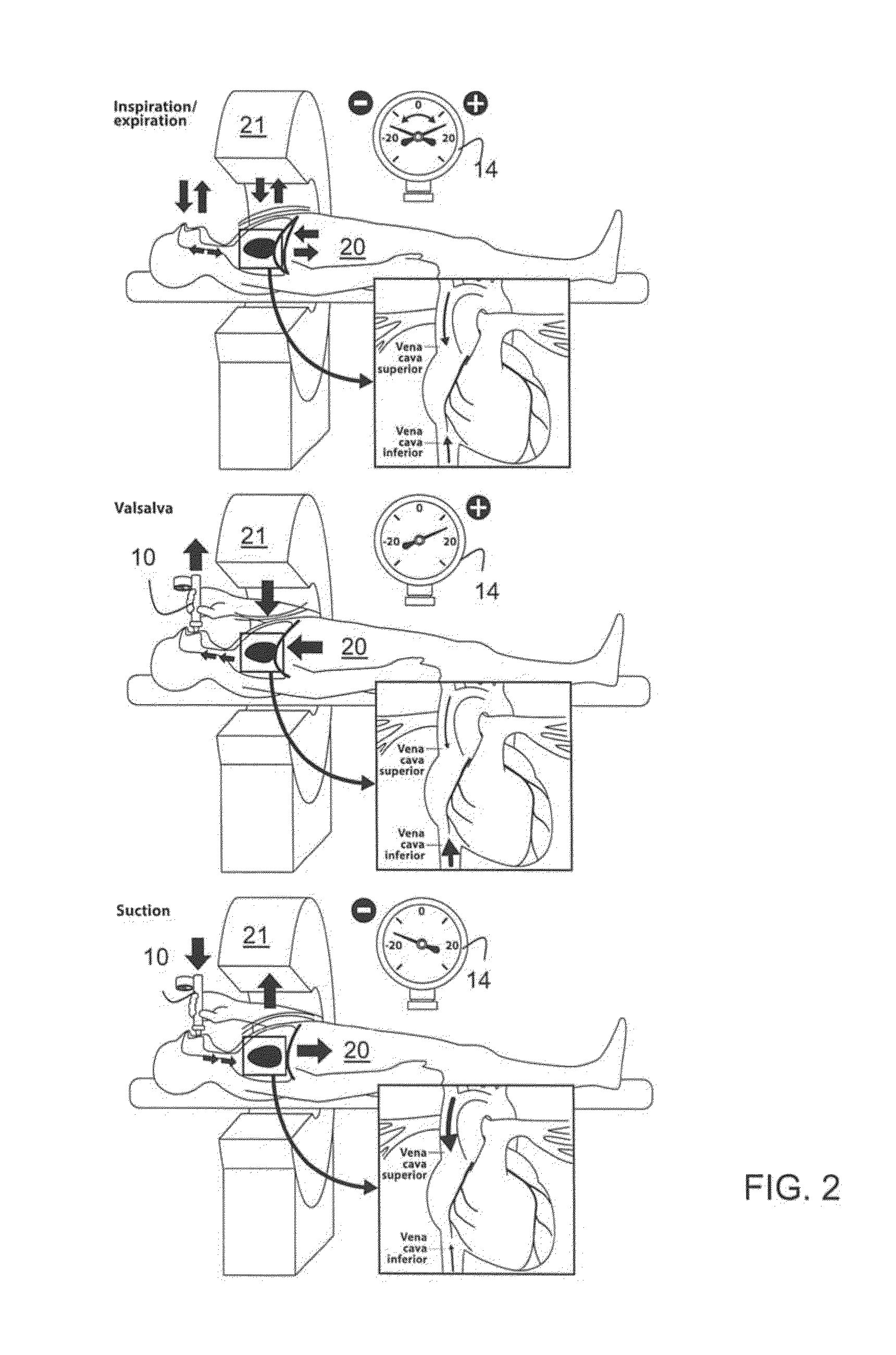 Blood flow control system and methods for in-vivo imaging and other applications