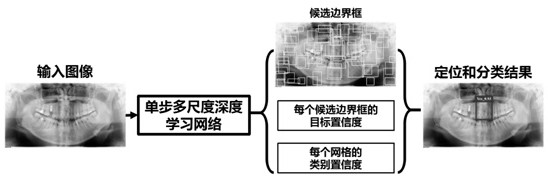 Single-step deep network-based automatic detection method for median multiple raw teeth in curved surface body layer graph