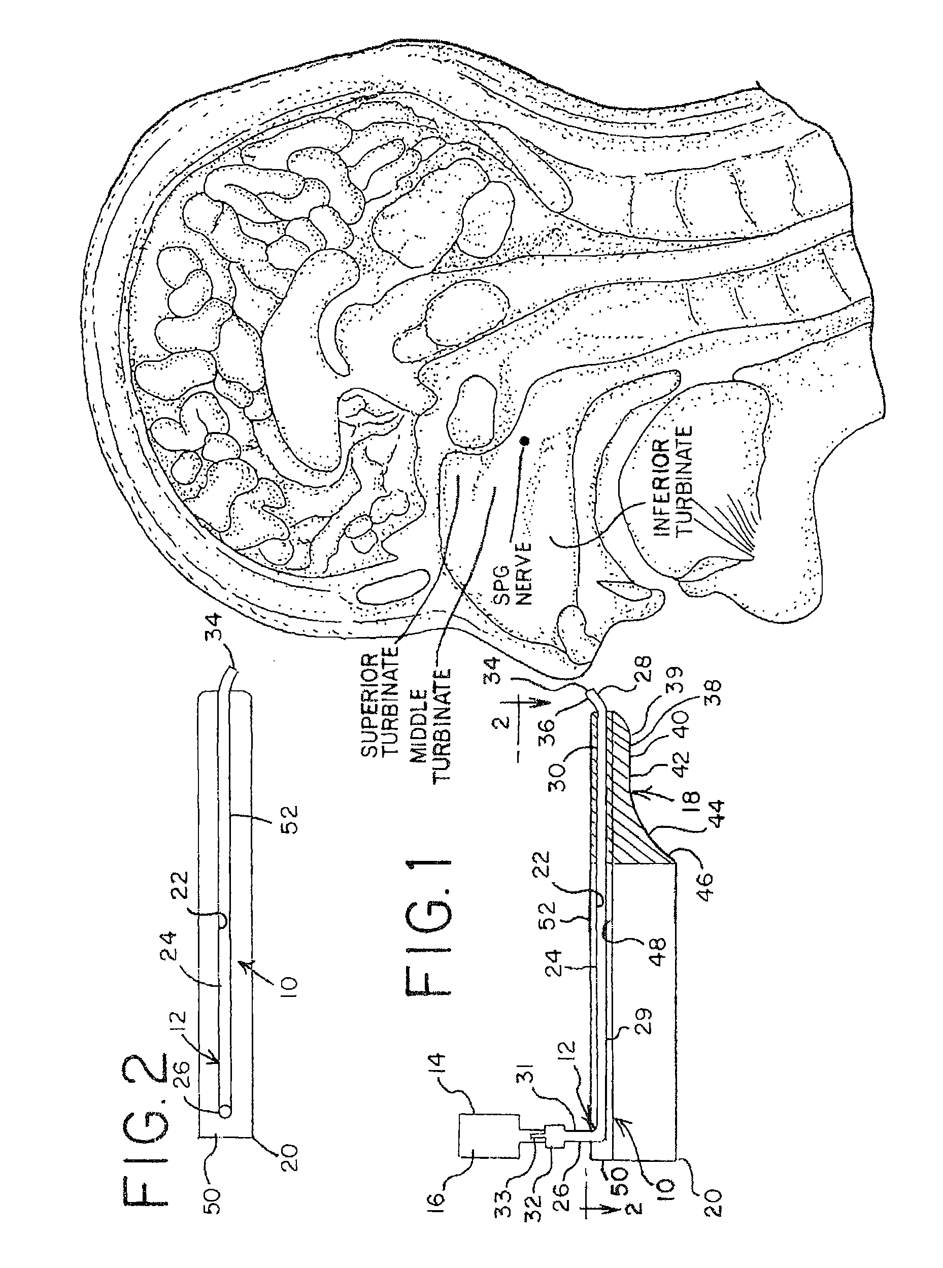 Methods for Ameliorating Pain and Devices for Delivering a Medicament