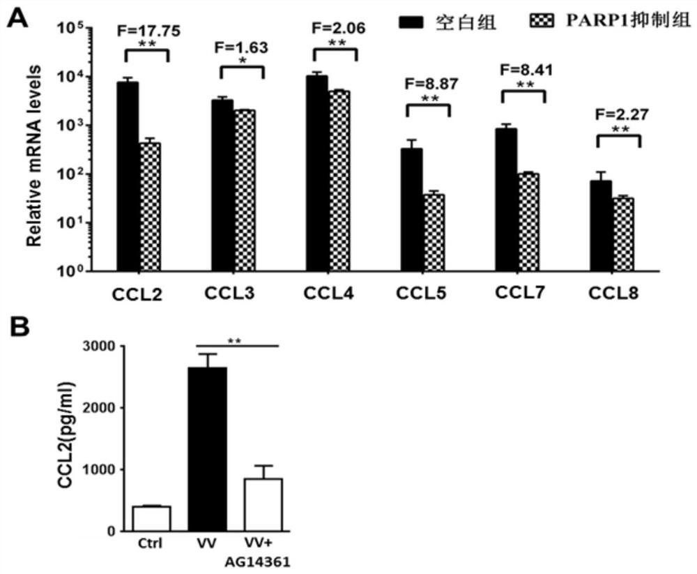Application of parp1 inhibitor in preparation of tumor immunotherapy preparation