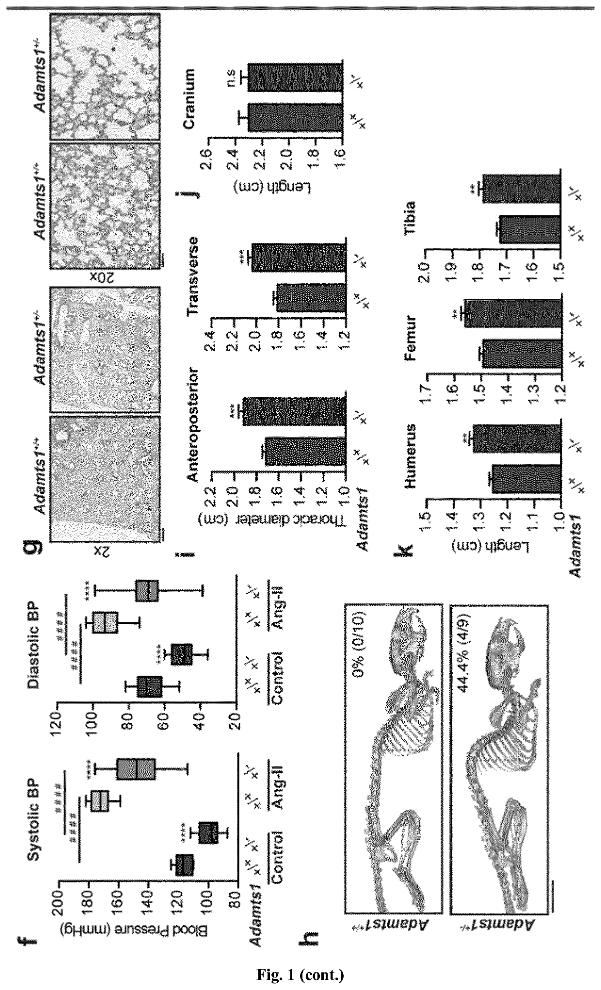 In vitro method for identifying thoracic aortic aneurysms (TAA) in a subject