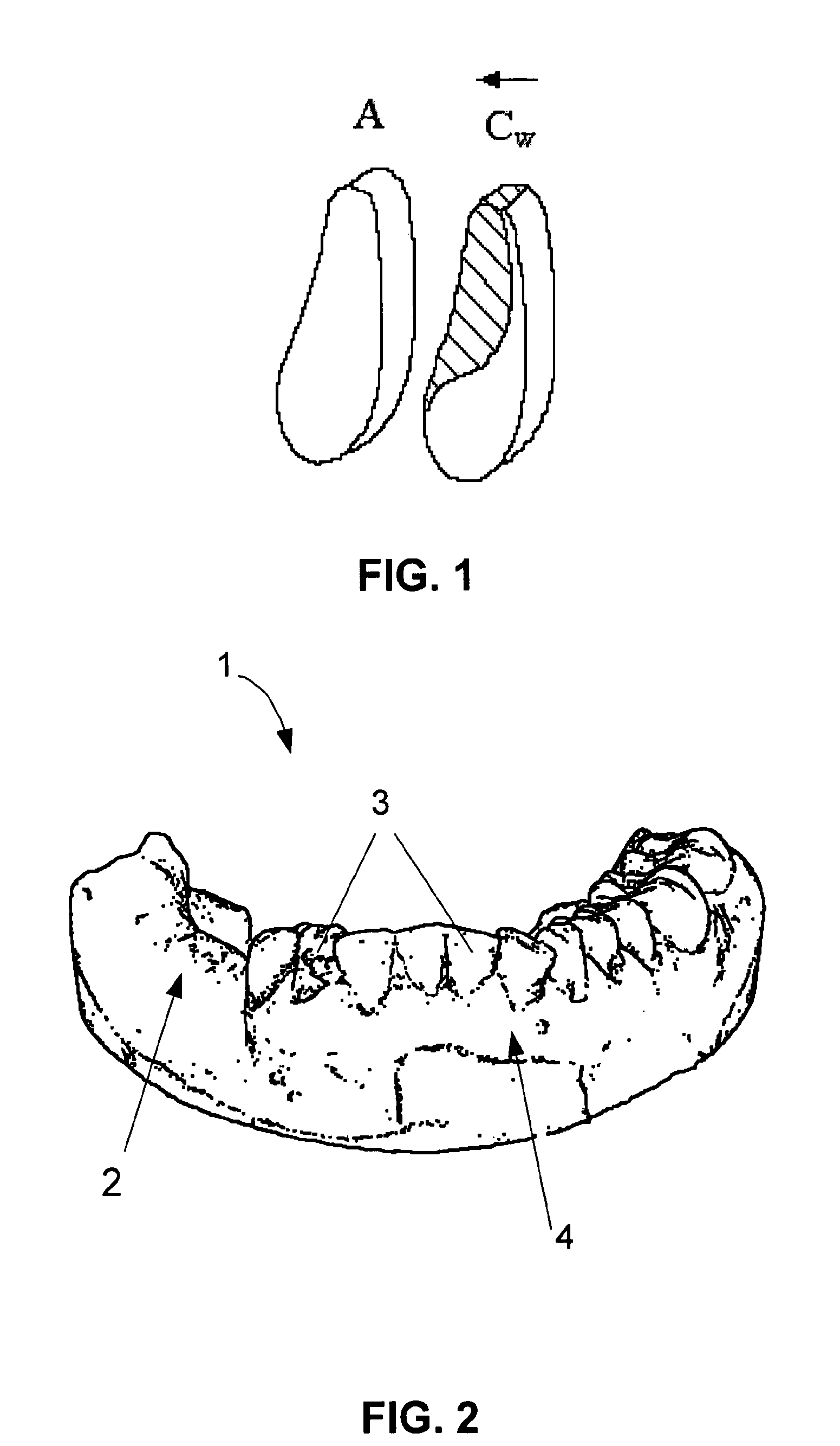Method for creating a personalized digital planning file for simulation of dental implant placement