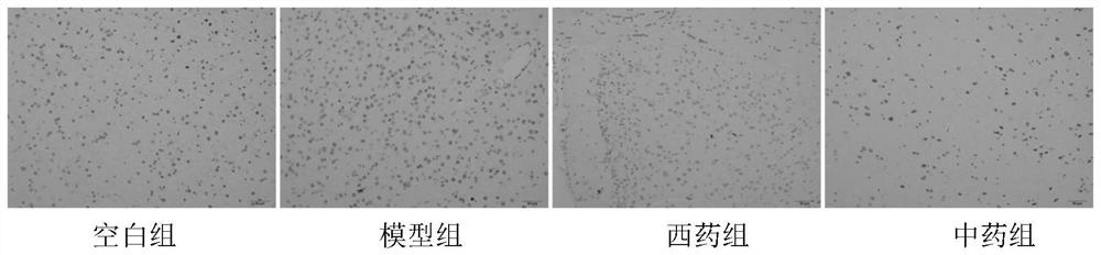 A traditional Chinese medicine composition for treating Parkinson's disease and its preparation method and application