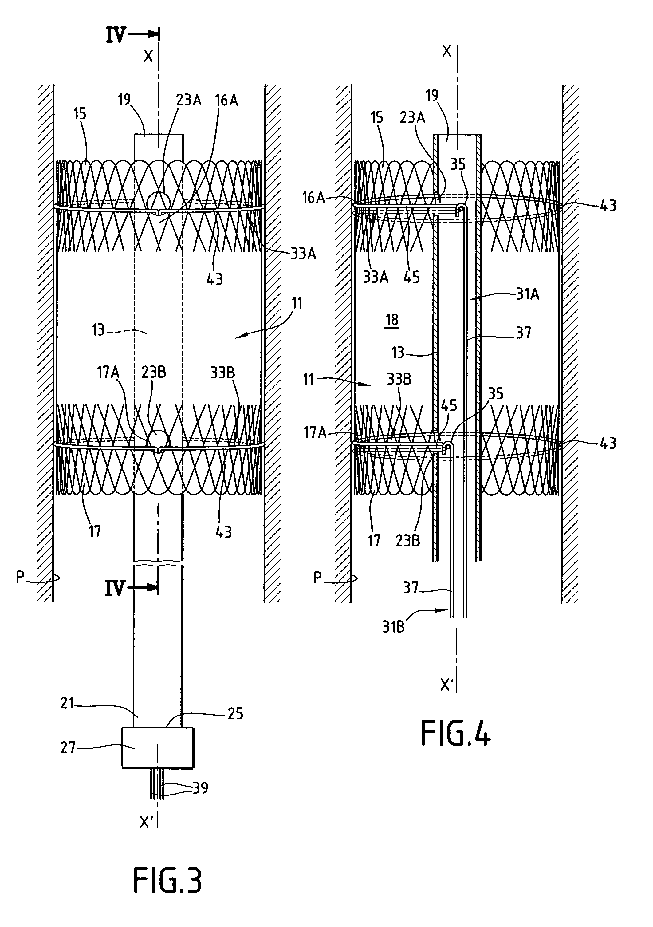 Device for treating a blood circulation canal and process for preparing this device