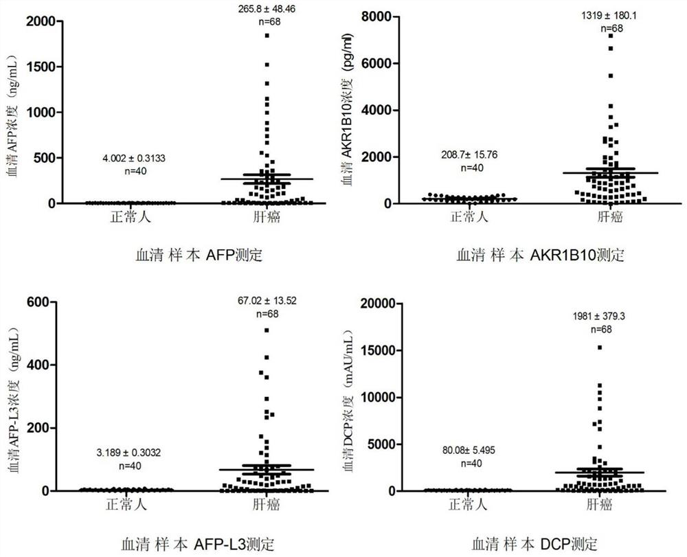 Early diagnosis kit based on combined detection of four items of liver cancer and application