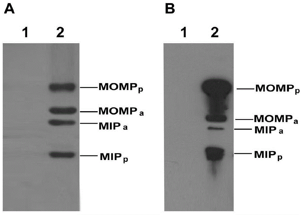 Co-expression vector of protective antigens momp and mip of Chlamydia abortus and Chlamydia psittaci and its construction and expression method