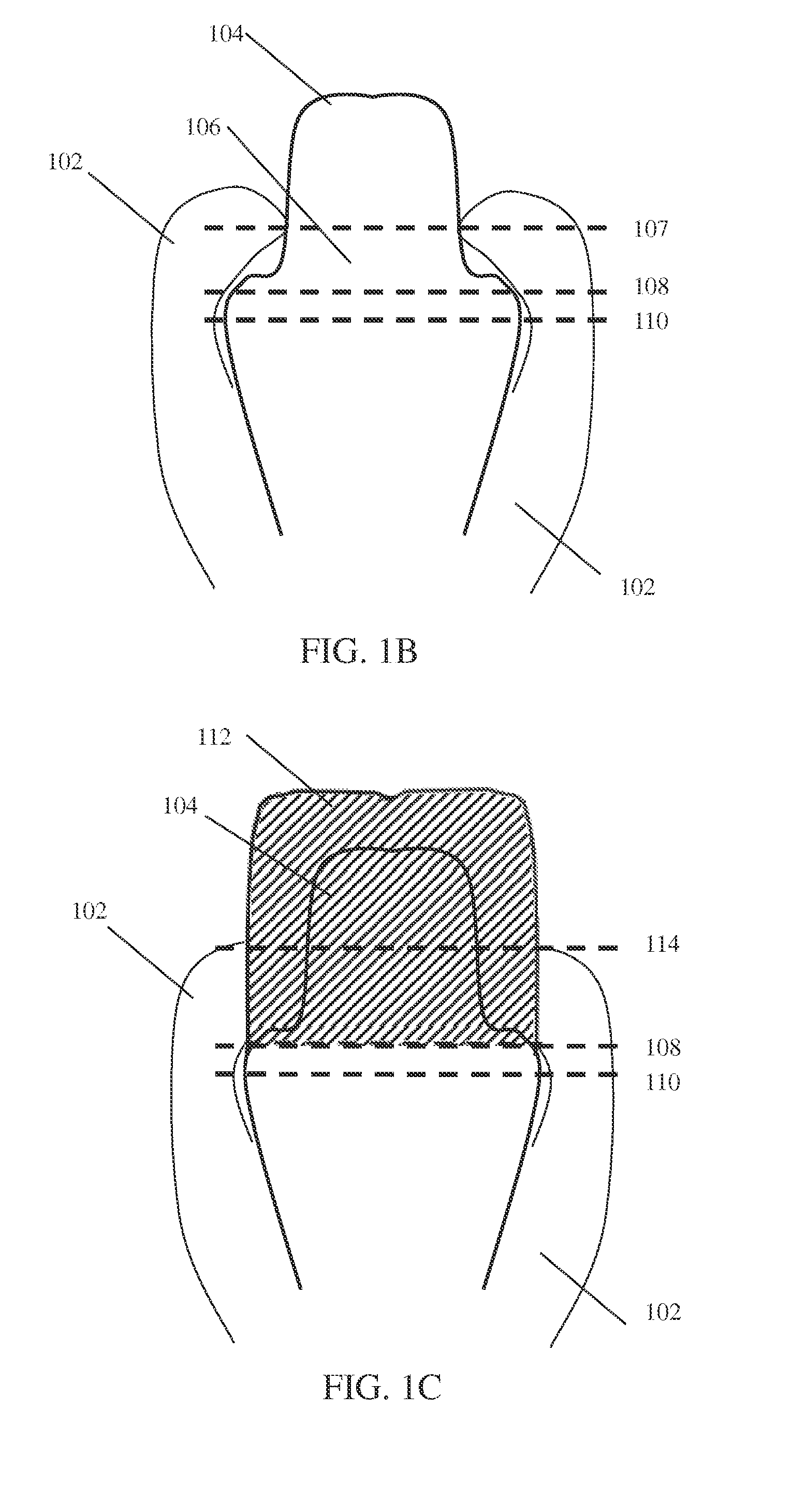 Device and method for subgingival measurement