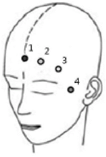 Wireless dynamic anesthesia depth detection method based on lattice complexity algorithm