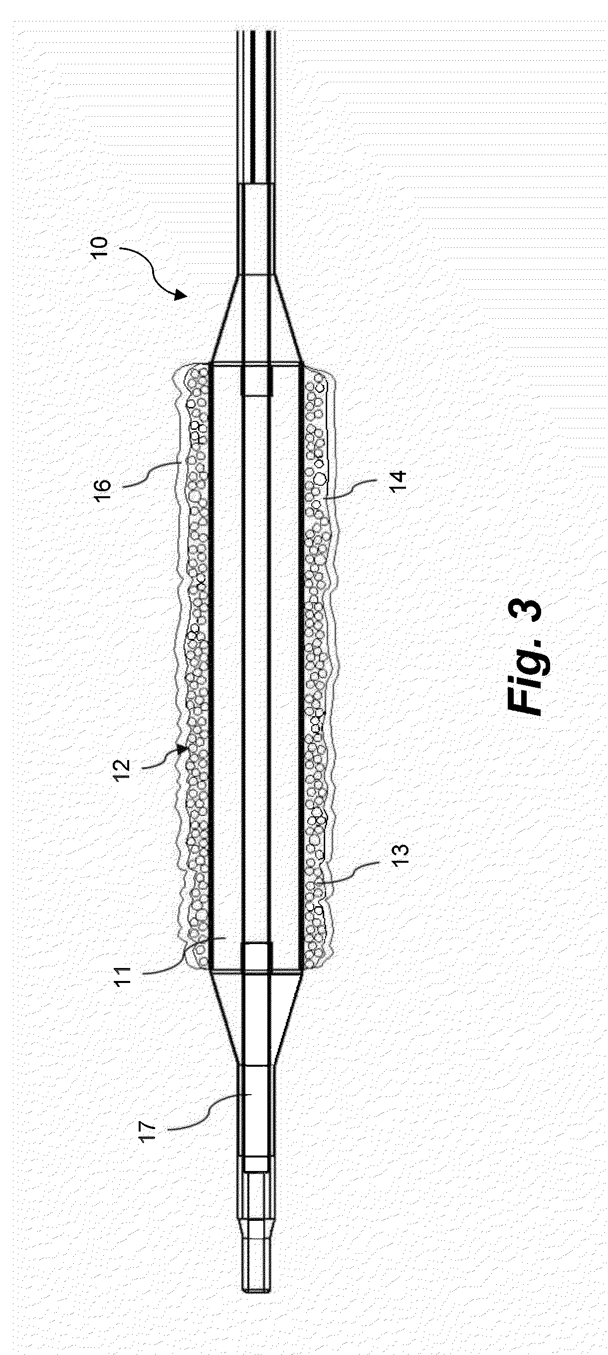 Coating for intraluminal expandable catheter providing contact transfer of drug micro-reservoirs