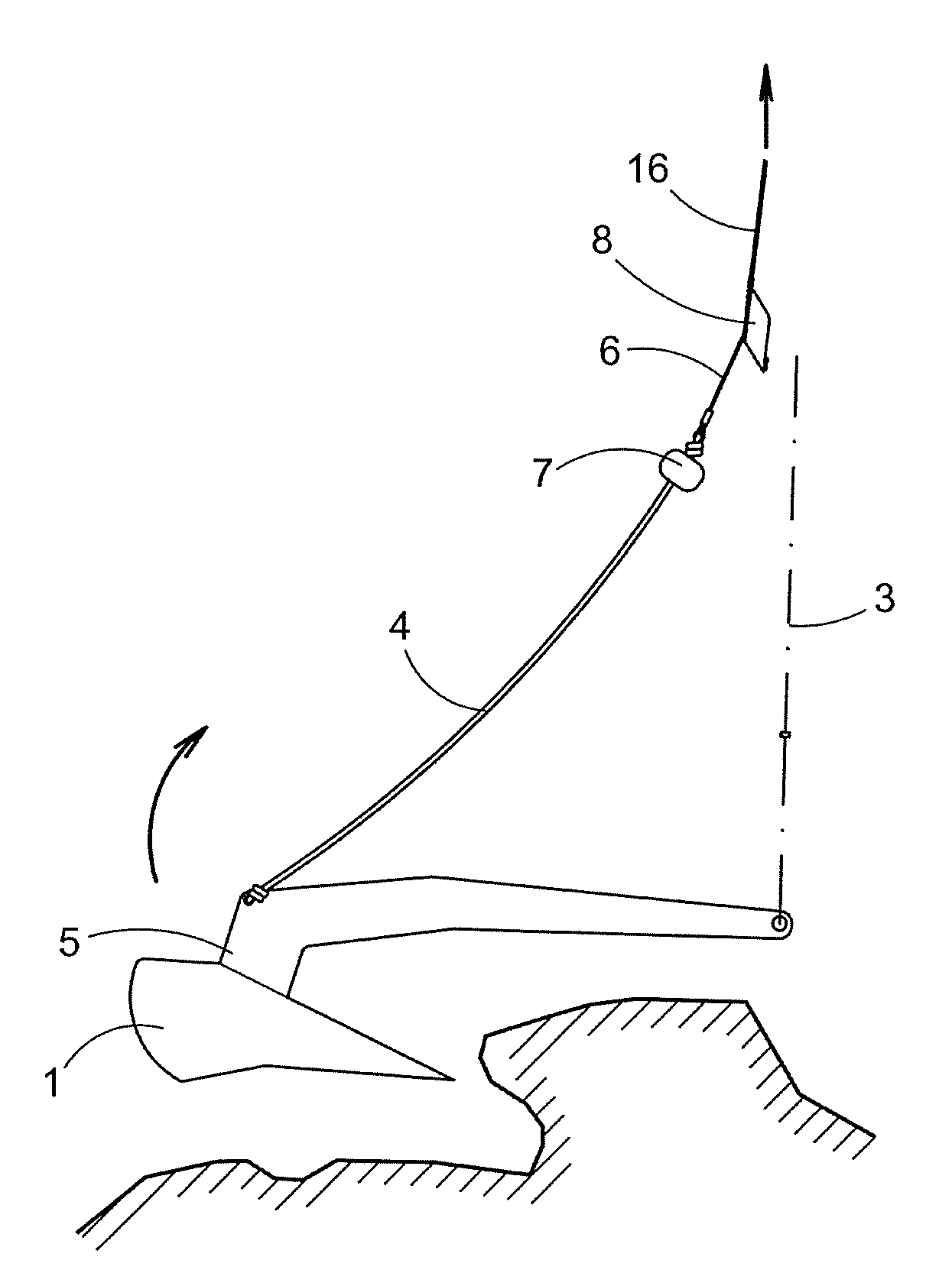 Anchor Retrieval Device