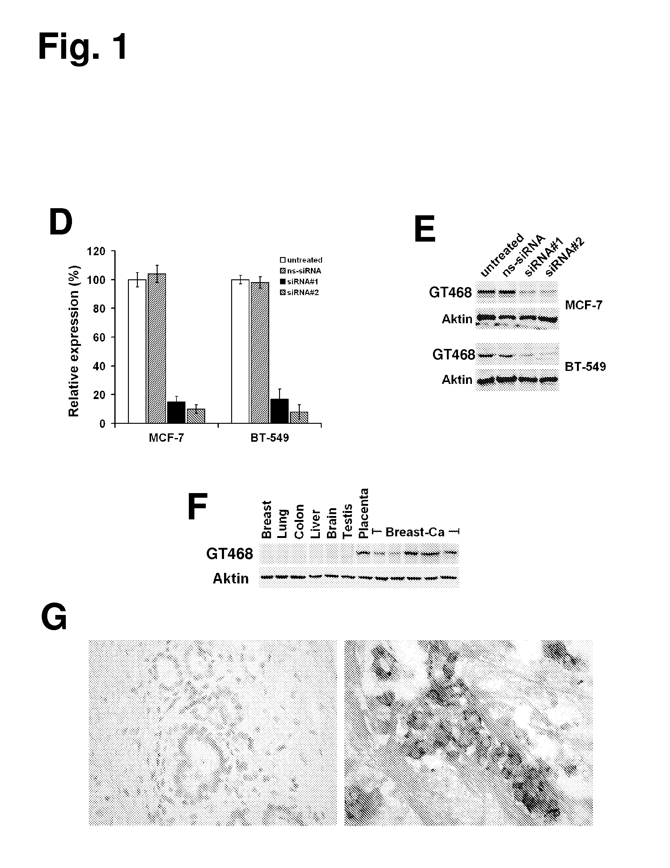Monoclonal antibodies for treatment of cancer