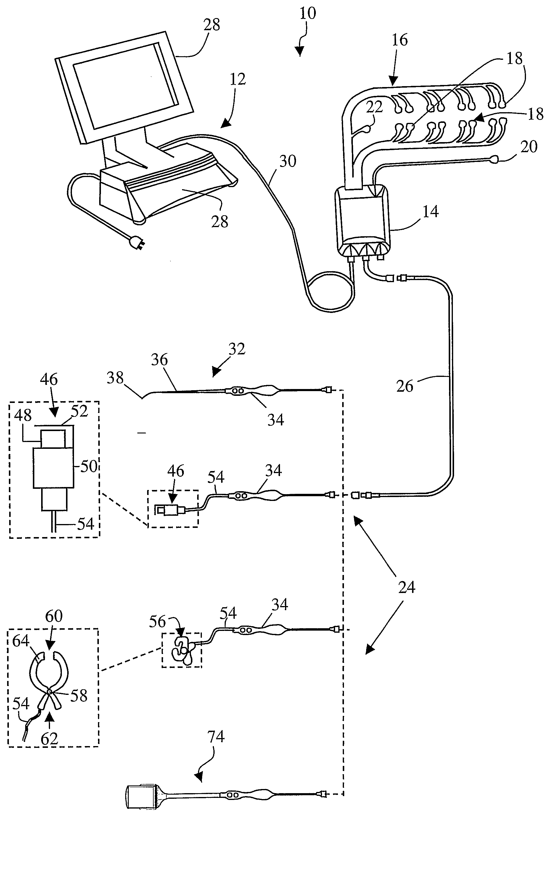 System and Methods for Monitoring During Anterior Surgery