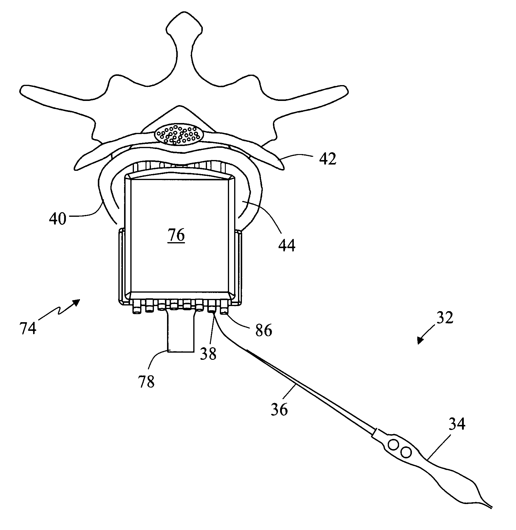 System and methods for monitoring during anterior surgery