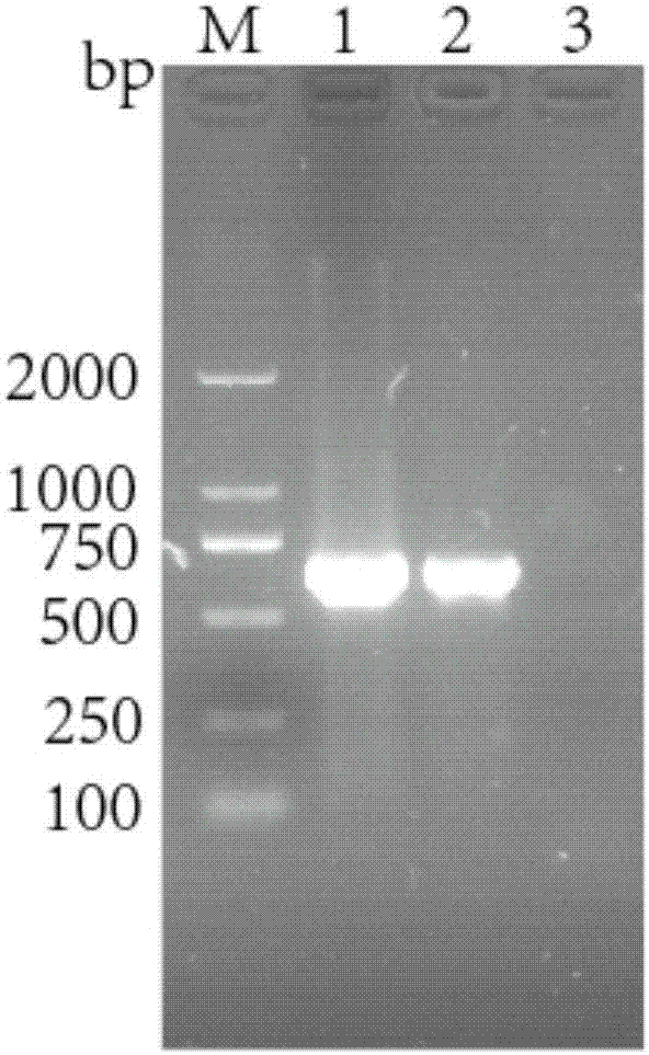Recombinant rabies virus carrying interleukin 6 gene and application thereof