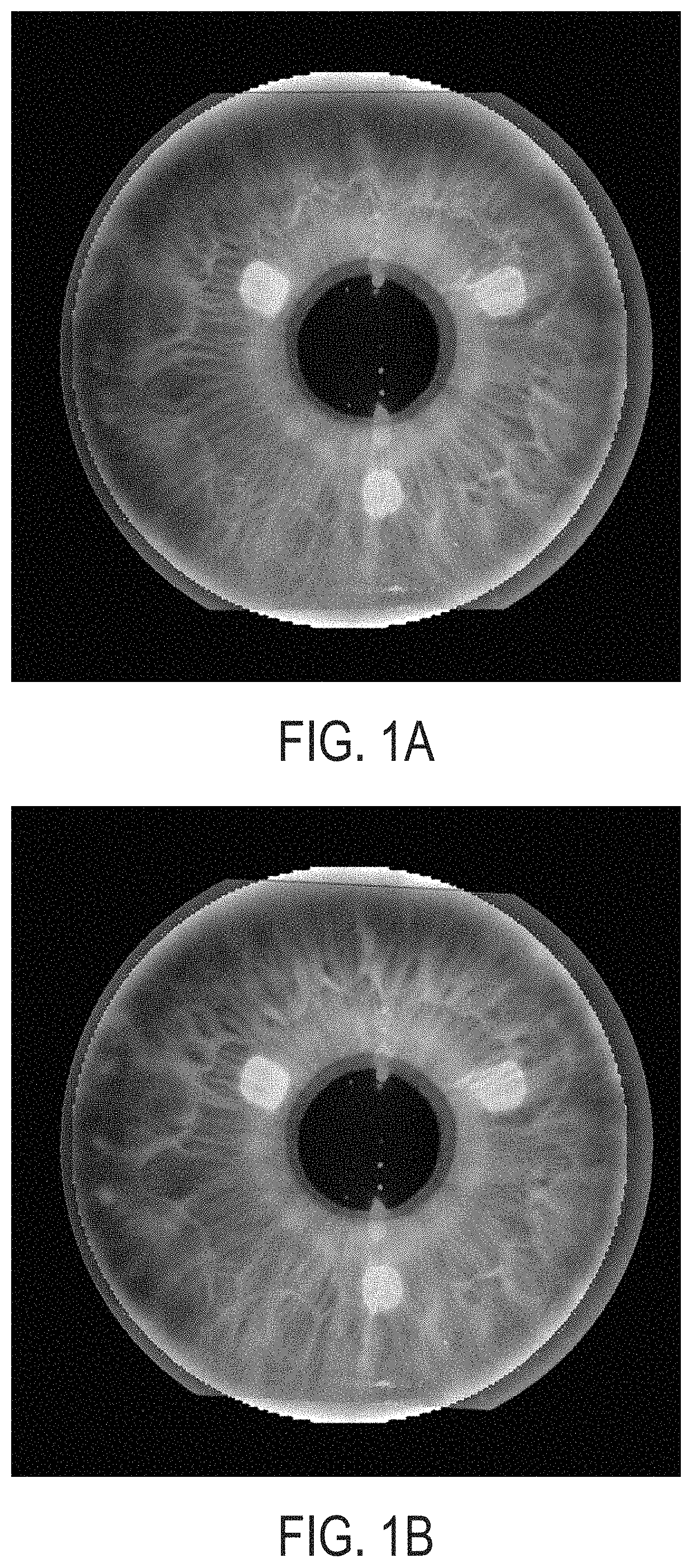 Overlay imaging for registration of a patient eye for laser surgery ...