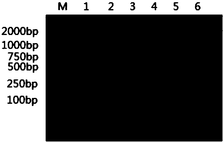 RPA primer for detecting transgenic corn Bt11 strain and detecting method