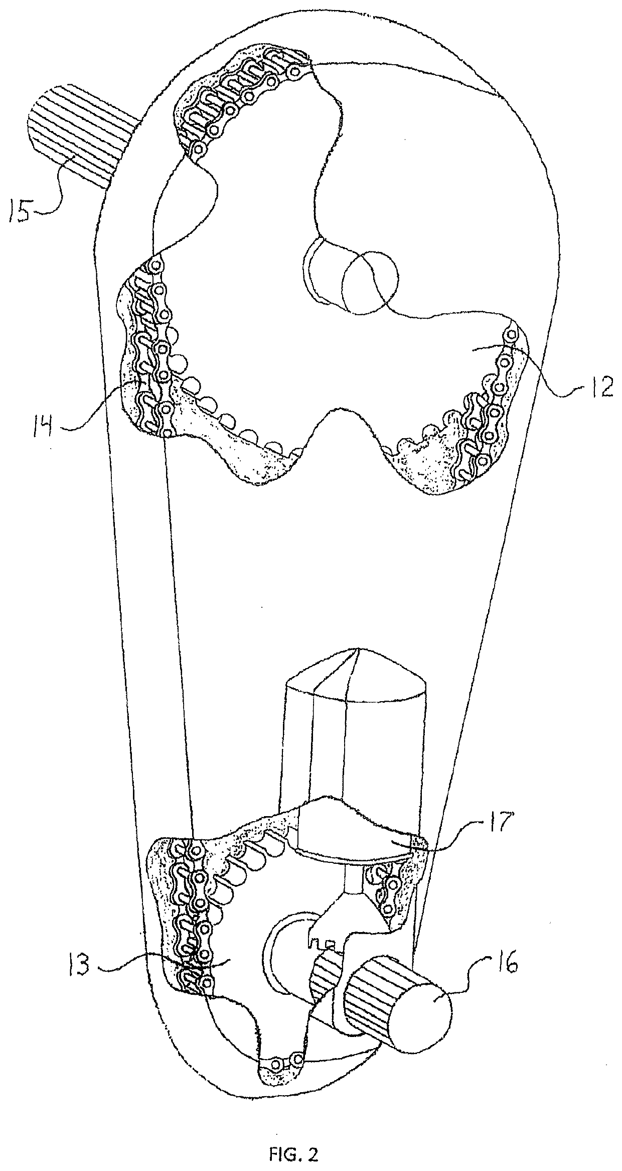 Augmented Rack and Pinion Steering System