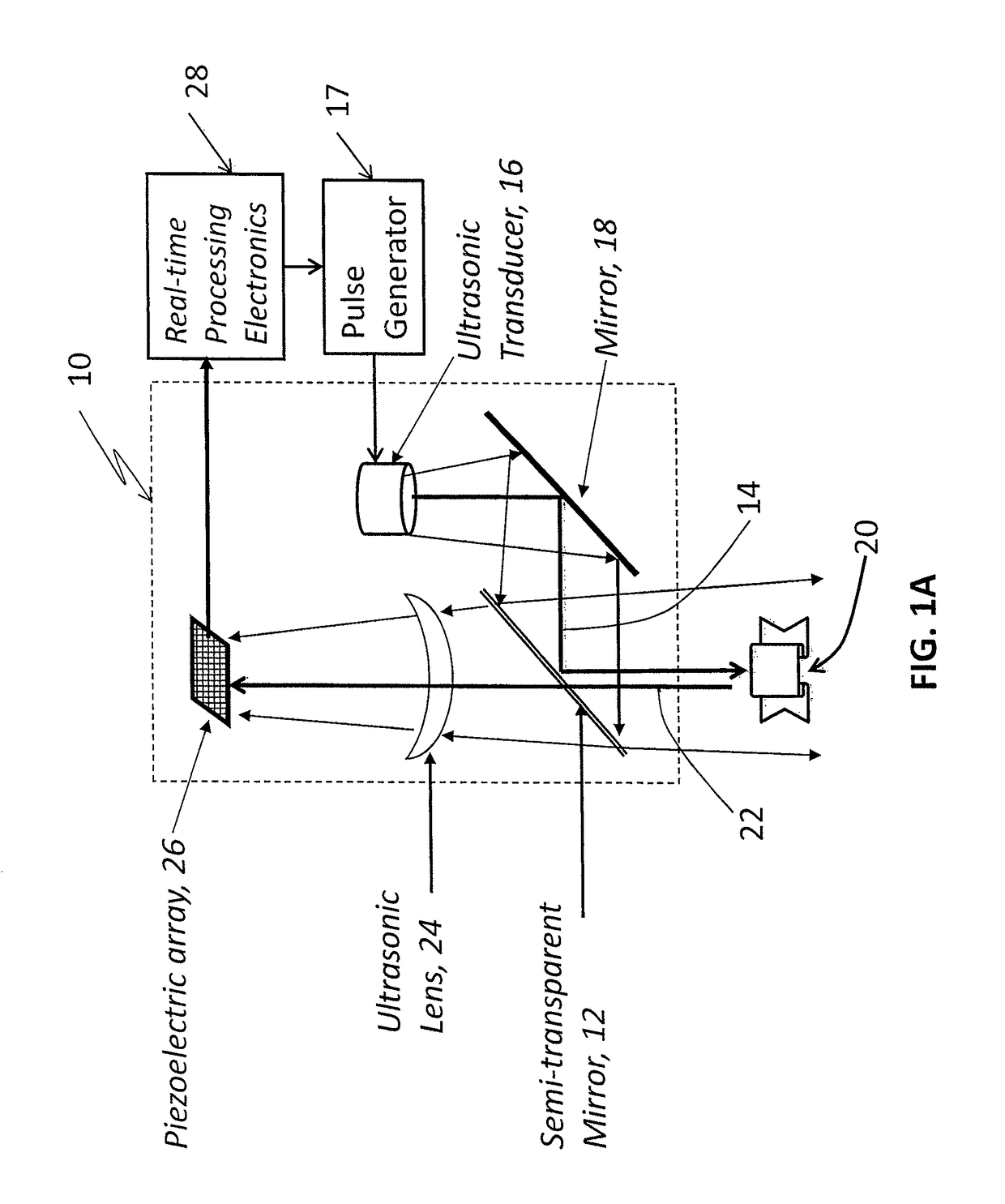 Acoustic camera