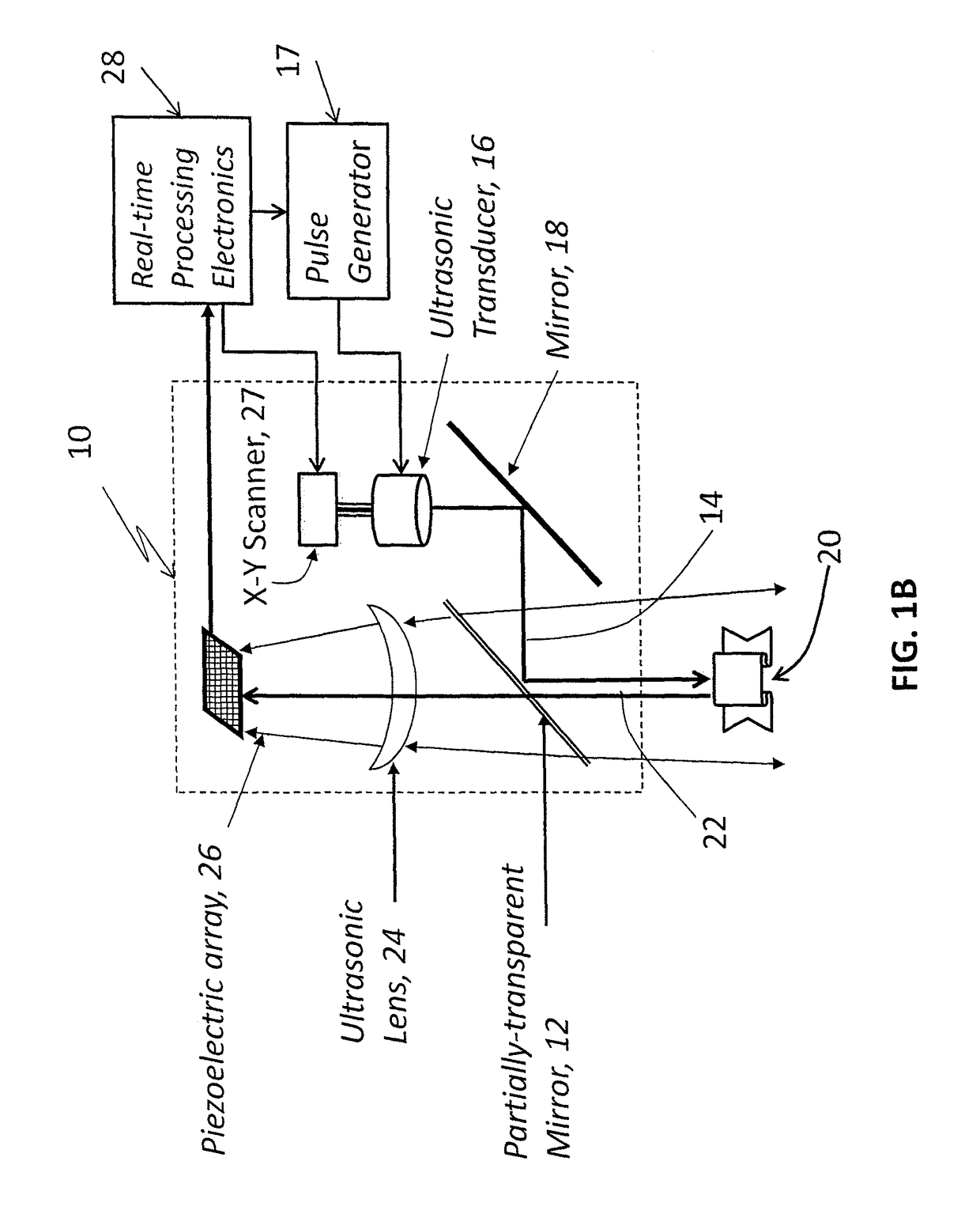 Acoustic camera