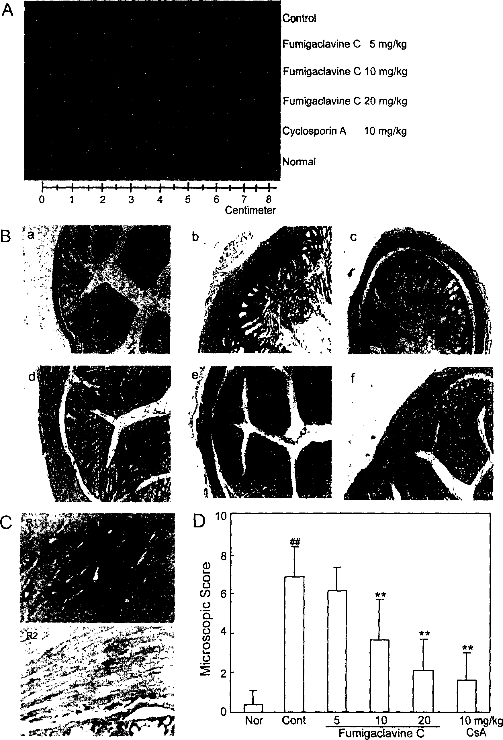 Application of fugillin in treating immunity entiritis and related immunity disease