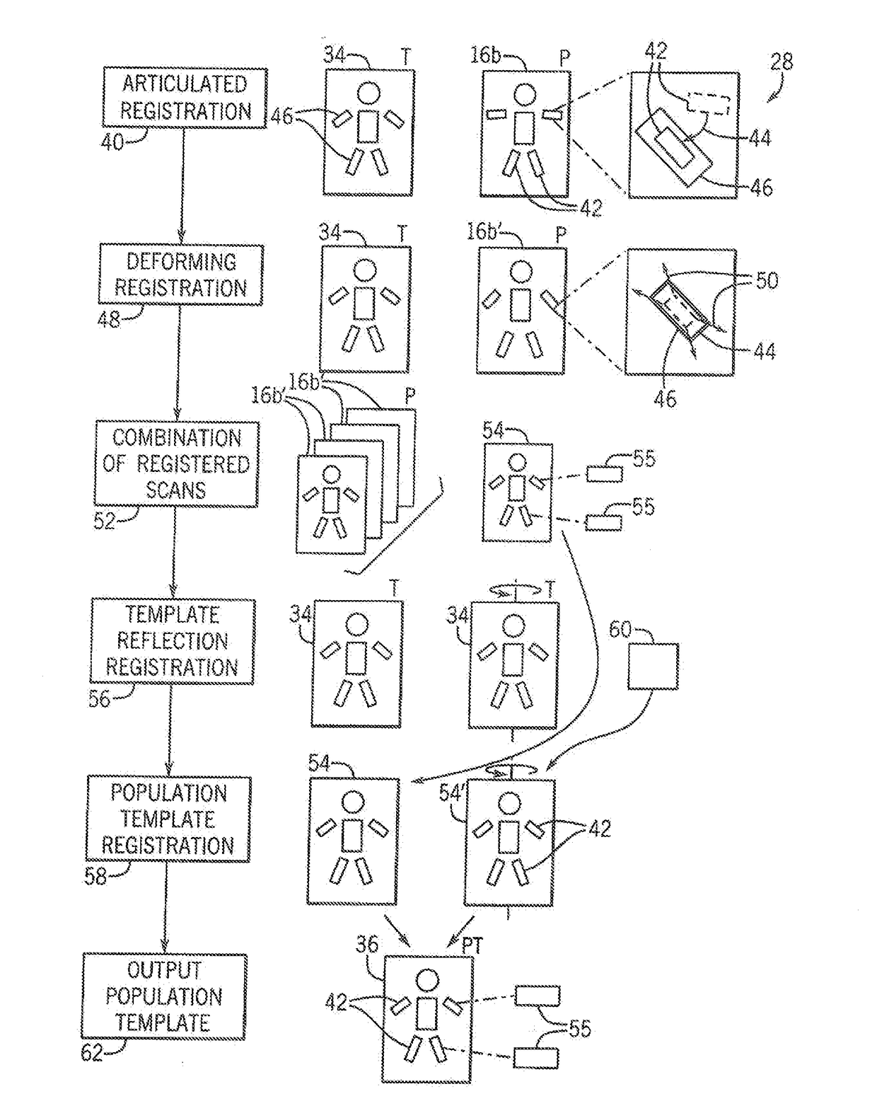 Image Enhancement System for Bone Disease Evaluation