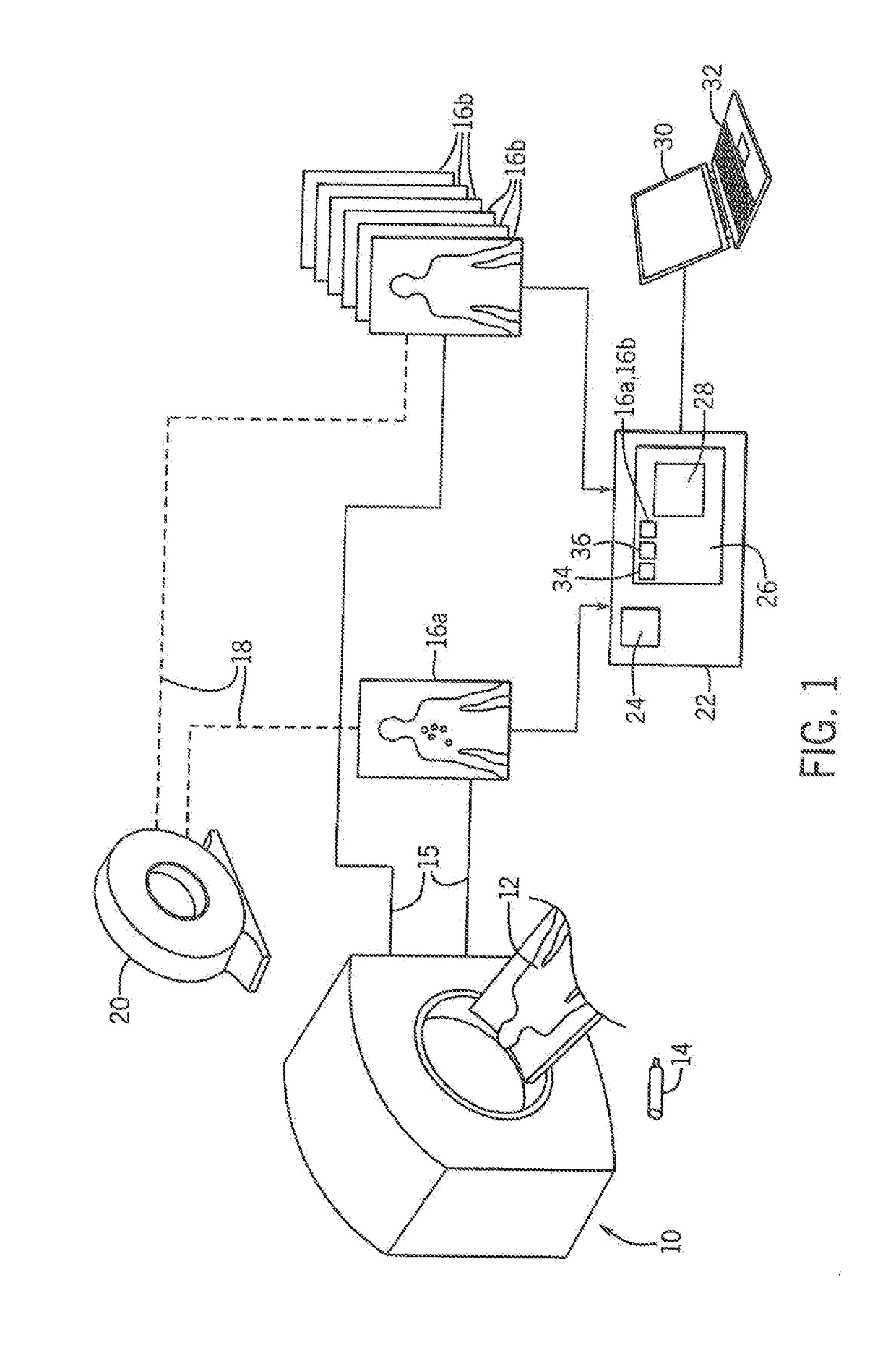 Image Enhancement System for Bone Disease Evaluation