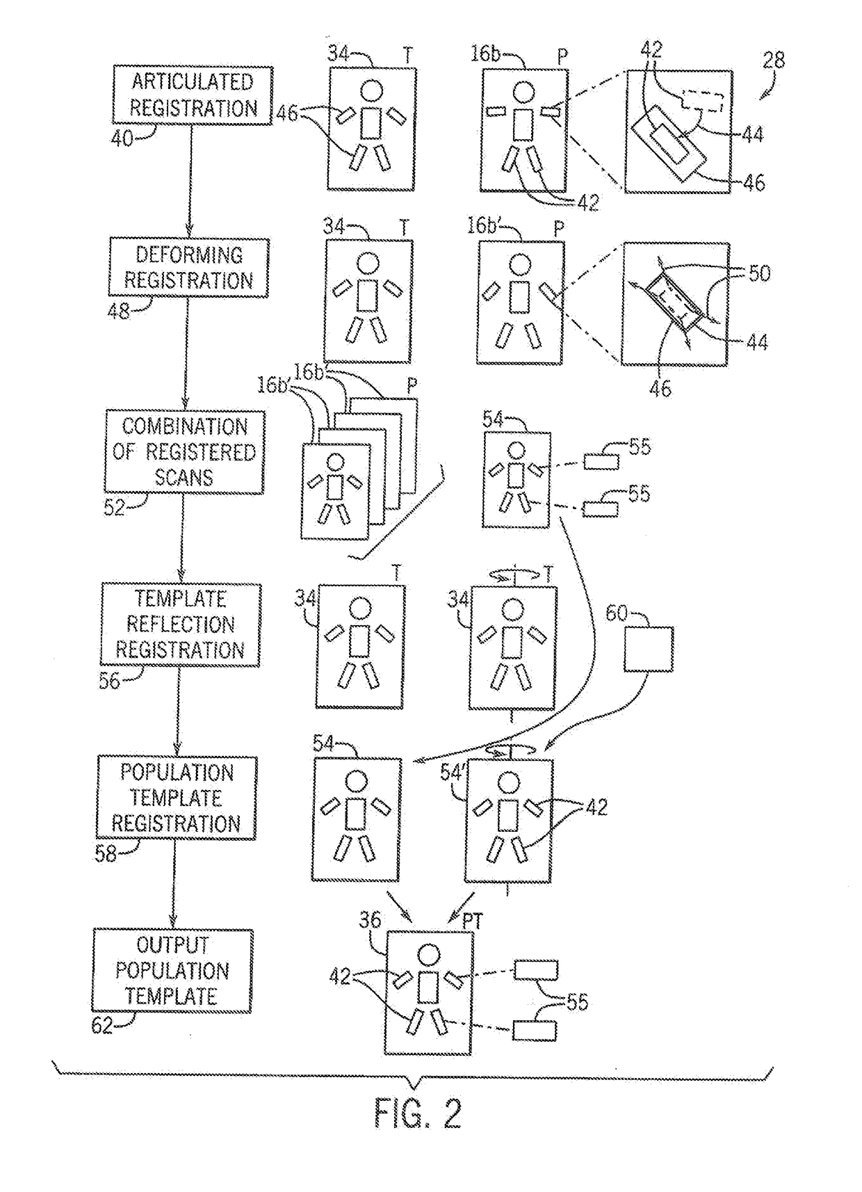 Image Enhancement System for Bone Disease Evaluation