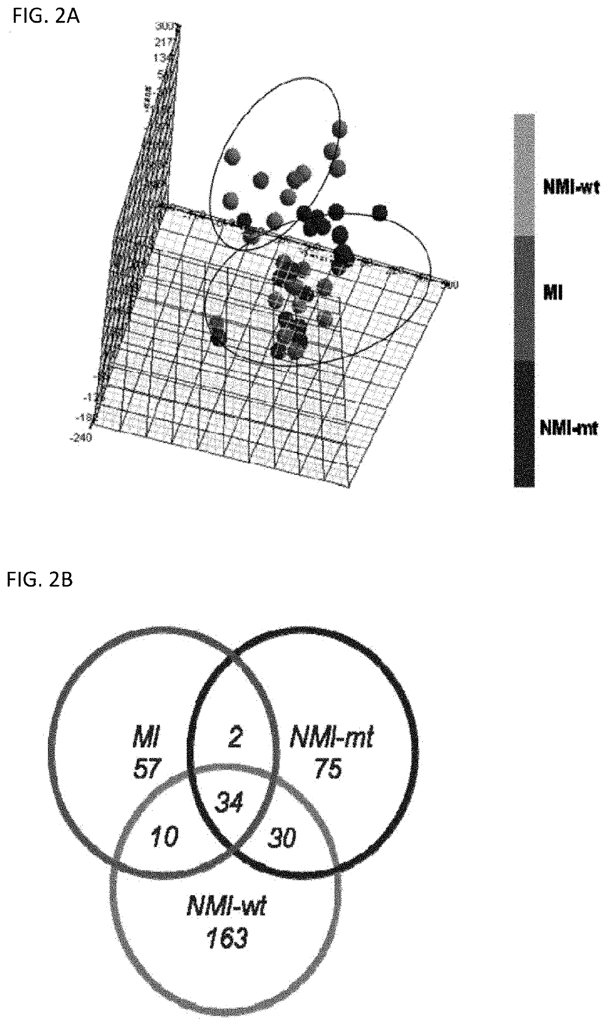 Method of diagnosing bladder cancer