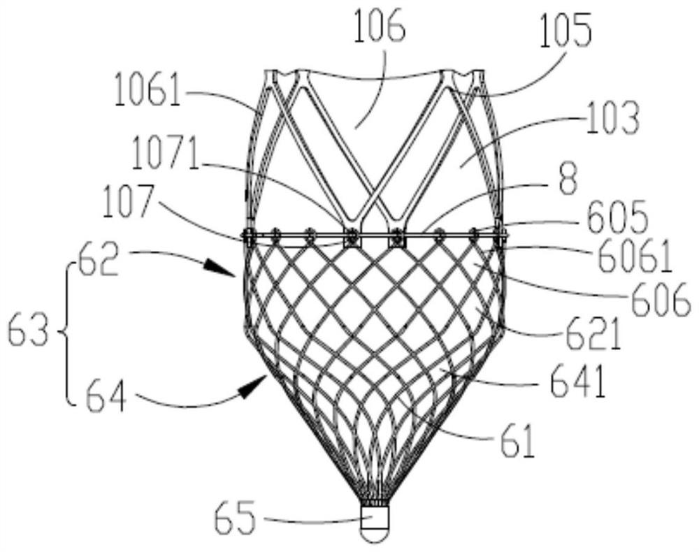 Thrombectomy stent and thrombectomy system