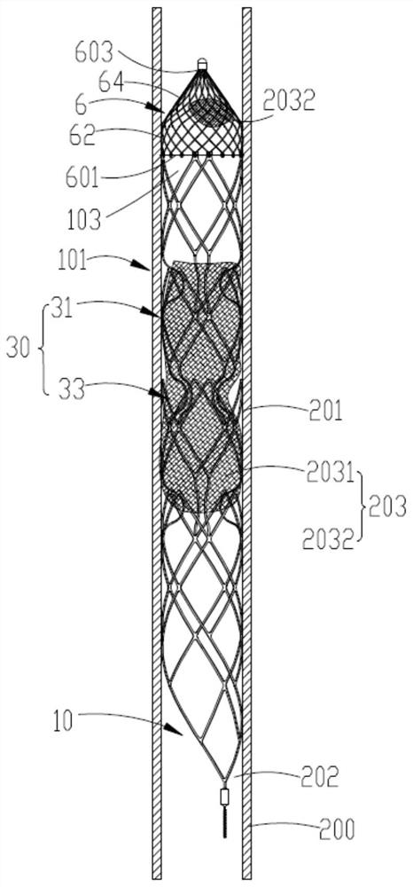 Thrombectomy stent and thrombectomy system