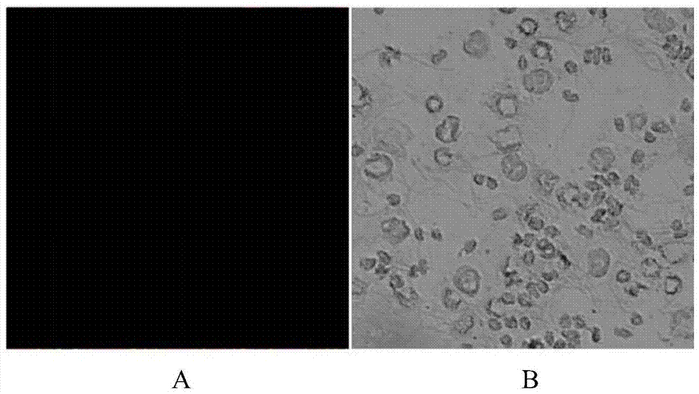 Antibody for detecting infectious spleen and kidney necrosis virus and its preparation and application