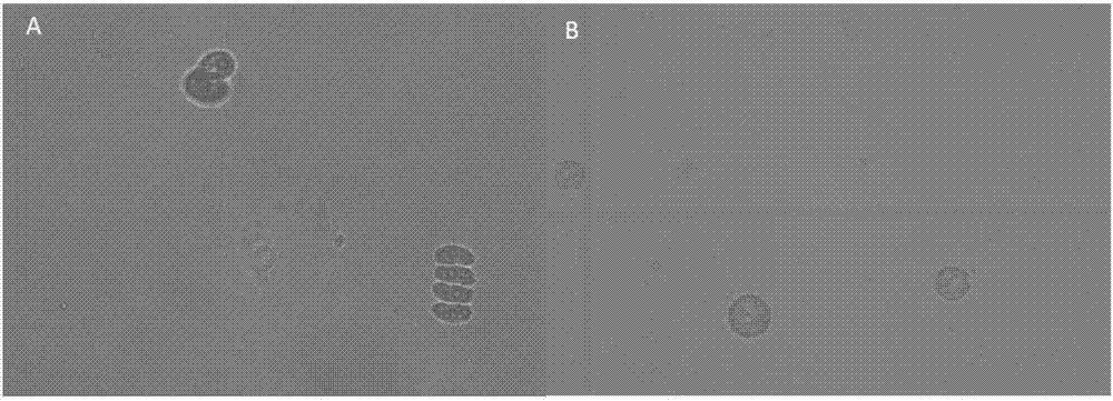 Method for preparing scenedesmusobliquus cell protoplast